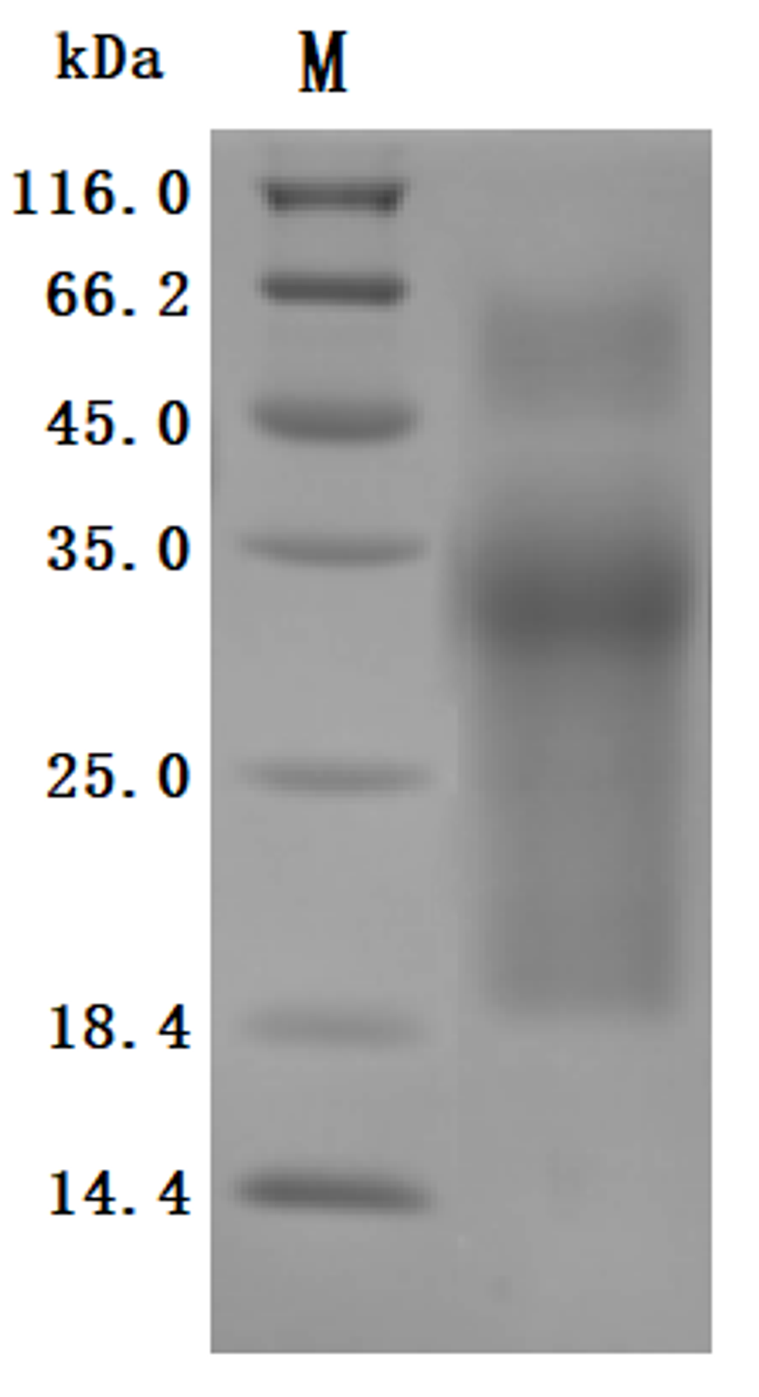 (Tris-Glycine gel) Discontinuous SDS-PAGE (reduced) with 5% enrichment gel and 15% separation gel.