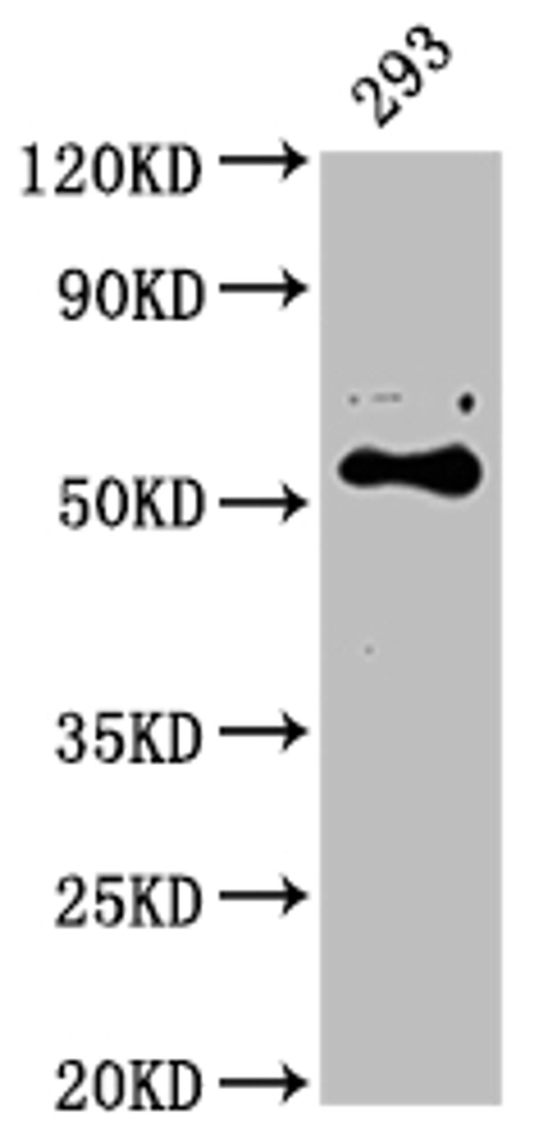 Western Blot. Positive WB detected in: 293 whole cell lysate. All lanes: CYP27B1 antibody at 1:2000. Secondary. Goat polyclonal to rabbit IgG at 1/50000 dilution. Predicted band size: 57 kDa. Observed band size: 57 kDa. 