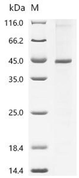 (Tris-Glycine gel) Discontinuous SDS-PAGE (reduced) with 5% enrichment gel and 15% separation gel.