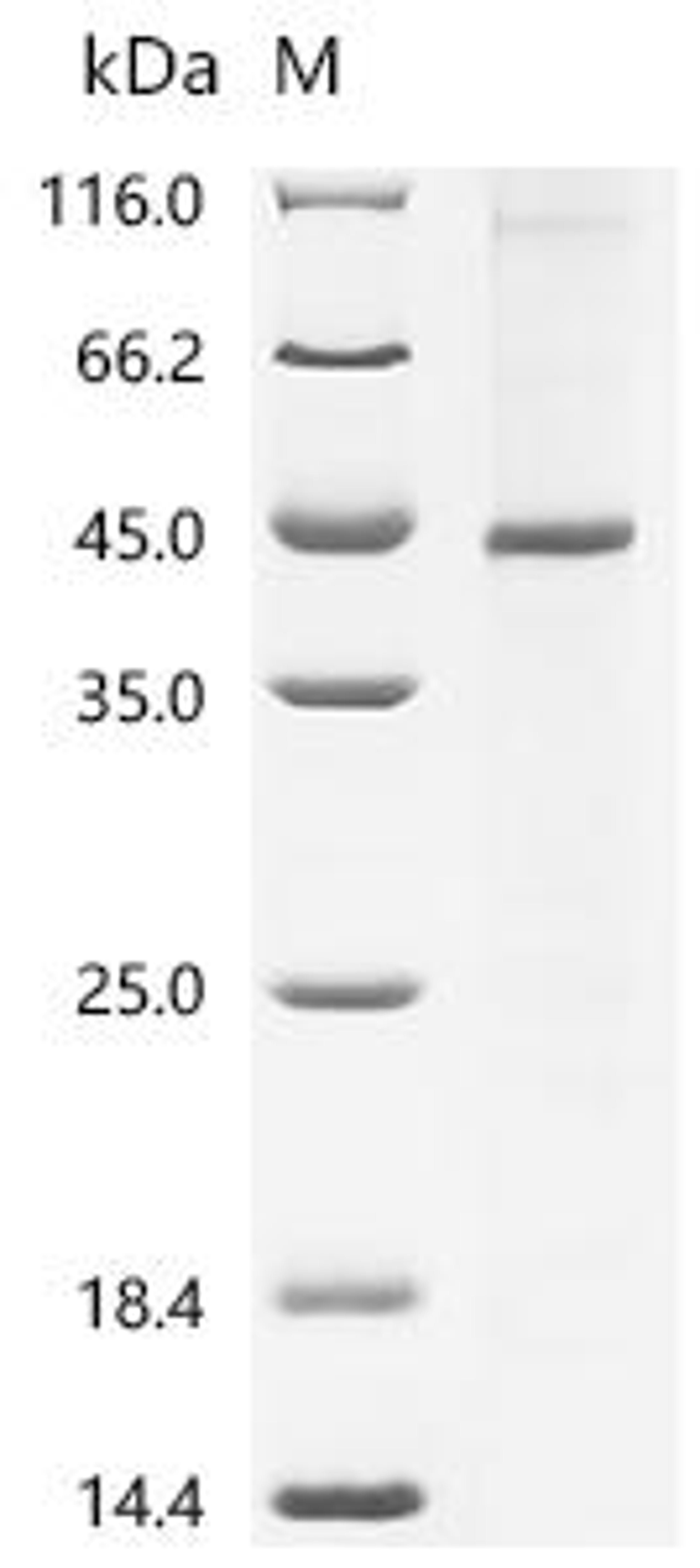 (Tris-Glycine gel) Discontinuous SDS-PAGE (reduced) with 5% enrichment gel and 15% separation gel.