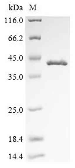 (Tris-Glycine gel) Discontinuous SDS-PAGE (reduced) with 5% enrichment gel and 15% separation gel.