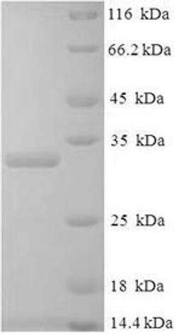 (Tris-Glycine gel) Discontinuous SDS-PAGE (reduced) with 5% enrichment gel and 15% separation gel.