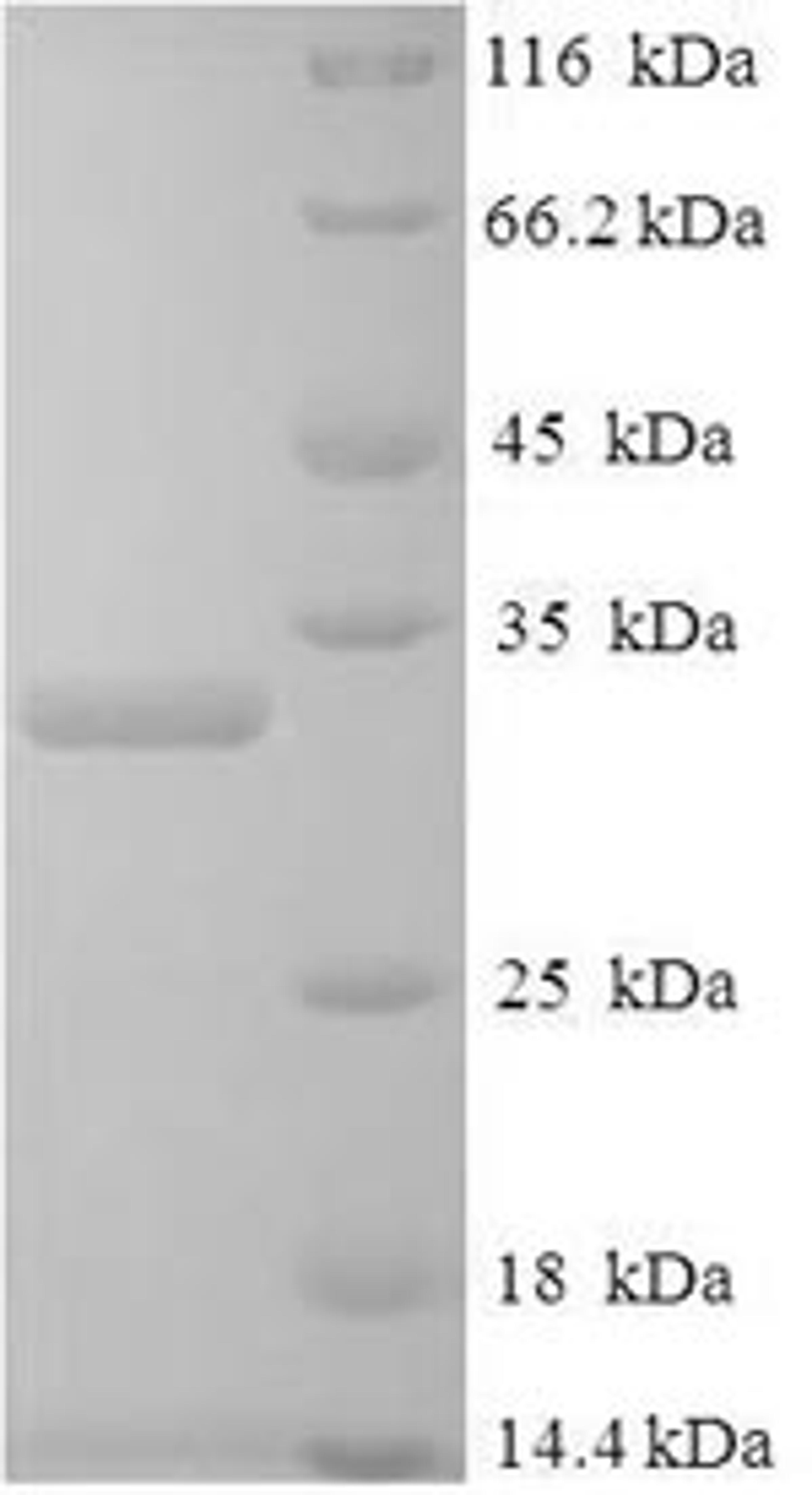 (Tris-Glycine gel) Discontinuous SDS-PAGE (reduced) with 5% enrichment gel and 15% separation gel.