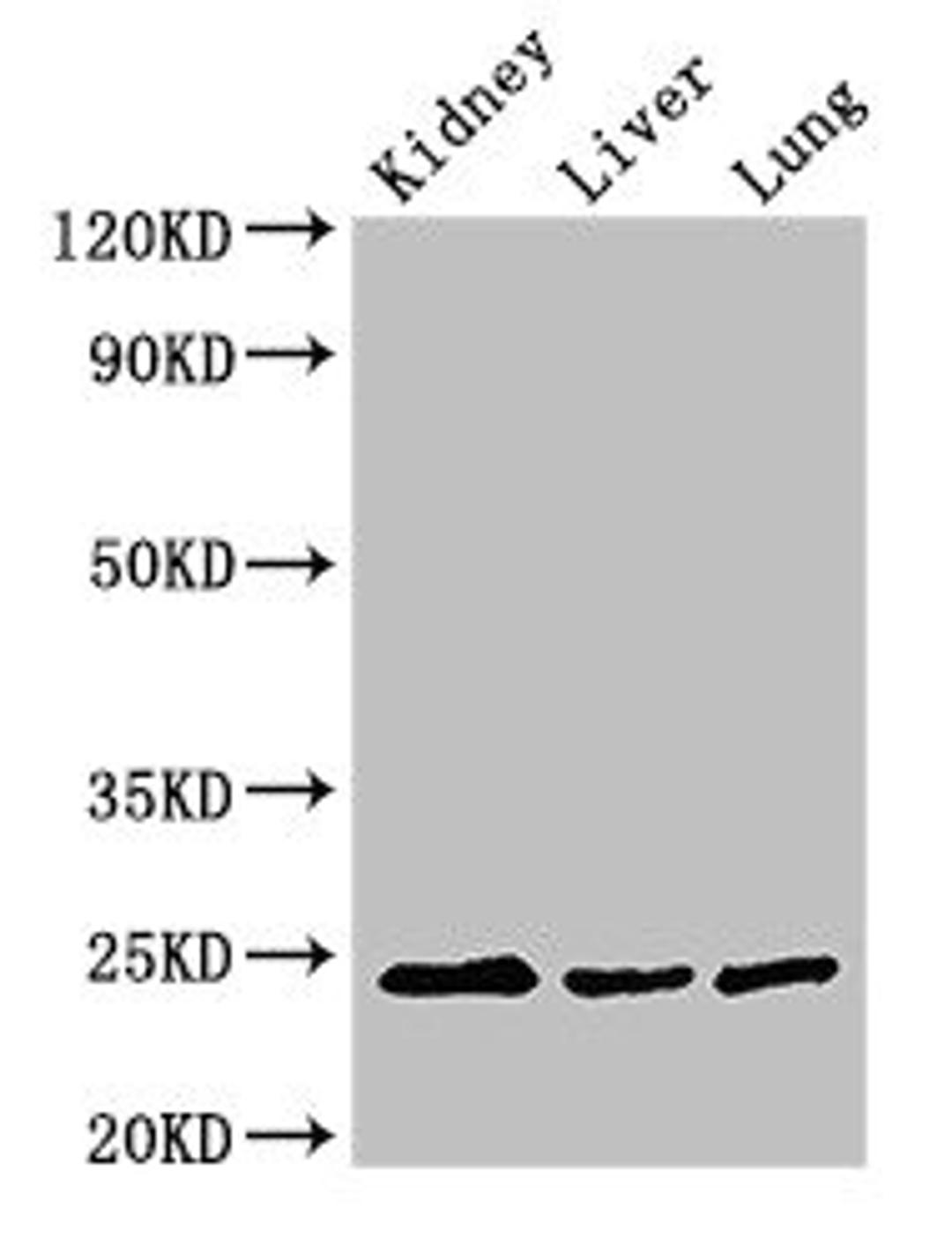 Western Blot. Positive WB detected in: Mouse kidney tissue, Mouse liver tissue, Rat lung tissue. All lanes: RAB5A antibody at 3ug/ml. Secondary. Goat polyclonal to rabbit IgG at 1/50000 dilution. Predicted band size: 24, 23 kDa. Observed band size: 24 kDa. 