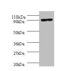 Western blot. All lanes: Aquaticus DNA polymerase I, thermostable antibody at 2ug/ml + 293T whole cell lysate. Secondary. Goat polyclonal to rabbit IgG at 1/10000 dilution. Predicted band size: 94 kDa. Observed band size: 94 kDa. 