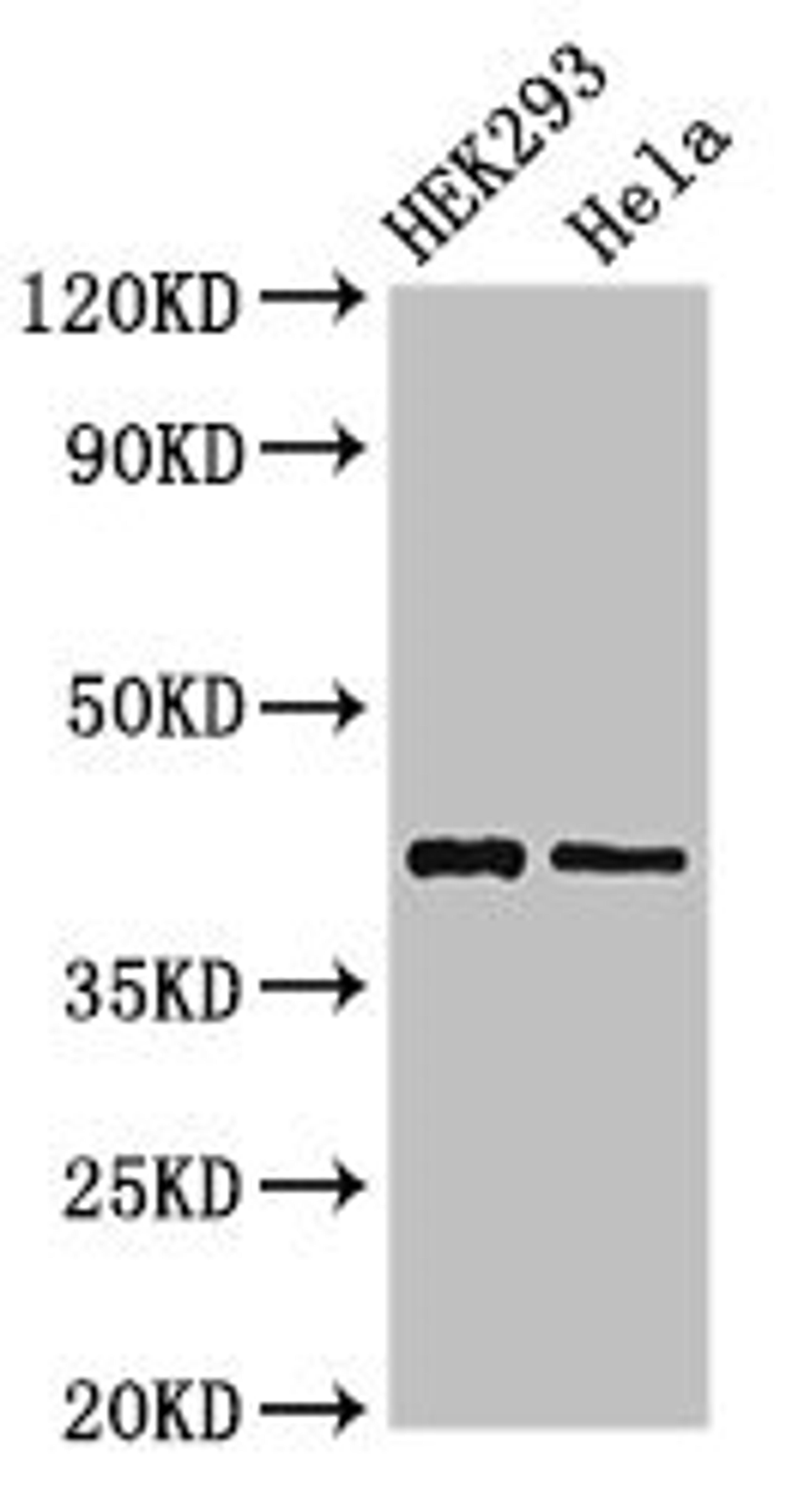 Western Blot. Positive WB detected in: HEK293 whole cell lysate, Hela whole cell lysate. All lanes: GALK1 antibody at 3ug/ml. Secondary. Goat polyclonal to rabbit IgG at 1/50000 dilution. Predicted band size: 43, 46 kDa. Observed band size: 43 kDa. 