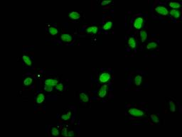 Immunofluorescent analysis of Hela cells using CSB-PA010380PA25me1HU at dilution of 1:100 and Alexa Fluor 488-congugated AffiniPure Goat Anti-Rabbit IgG(H+L)