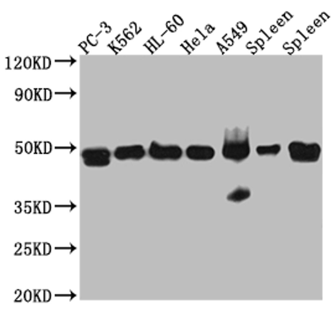 Western Blot. Positive WB detected in: PC-3 whole cell lysate, K562 whole cell lysate, HL-60 whole cell lysate, A549 whole cell lysate, Mouse Spleen whole cell lysate, Rat Spleen whole cell lysate. All lanes: Arp3 Antibody at 1:1000. Secondary. Goat polyclonal to rabbit IgG at 1/50000 dilution. Predicted band size: 48 kDa. Observed band size: 48 kDa. 