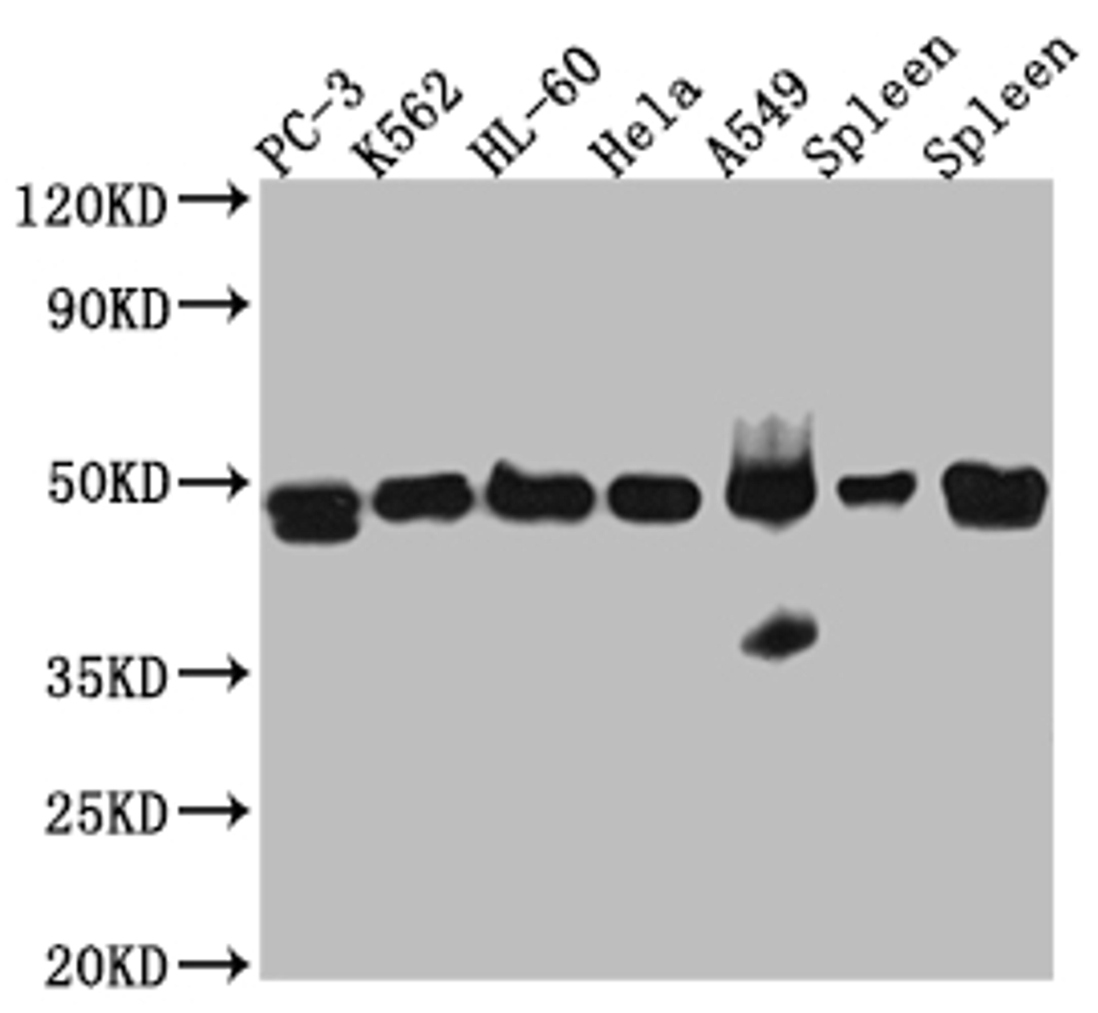 Western Blot. Positive WB detected in: PC-3 whole cell lysate, K562 whole cell lysate, HL-60 whole cell lysate, A549 whole cell lysate, Mouse Spleen whole cell lysate, Rat Spleen whole cell lysate. All lanes: Arp3 Antibody at 1:1000. Secondary. Goat polyclonal to rabbit IgG at 1/50000 dilution. Predicted band size: 48 kDa. Observed band size: 48 kDa.