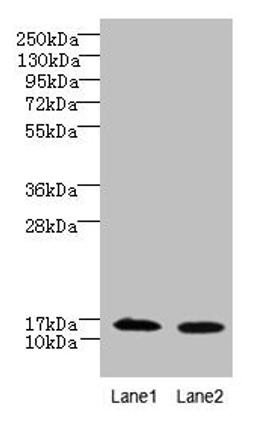 Western blot. All lanes: FAM136A antibody at 8µg/ml. Lane 1: Hela whole cell lysate. Lane 2: Caco-2 whole cell lysate. Secondary. Goat polyclonal to rabbit IgG at 1/10000 dilution. Predicted band size: 16 kDa. Observed band size: 16 kDa