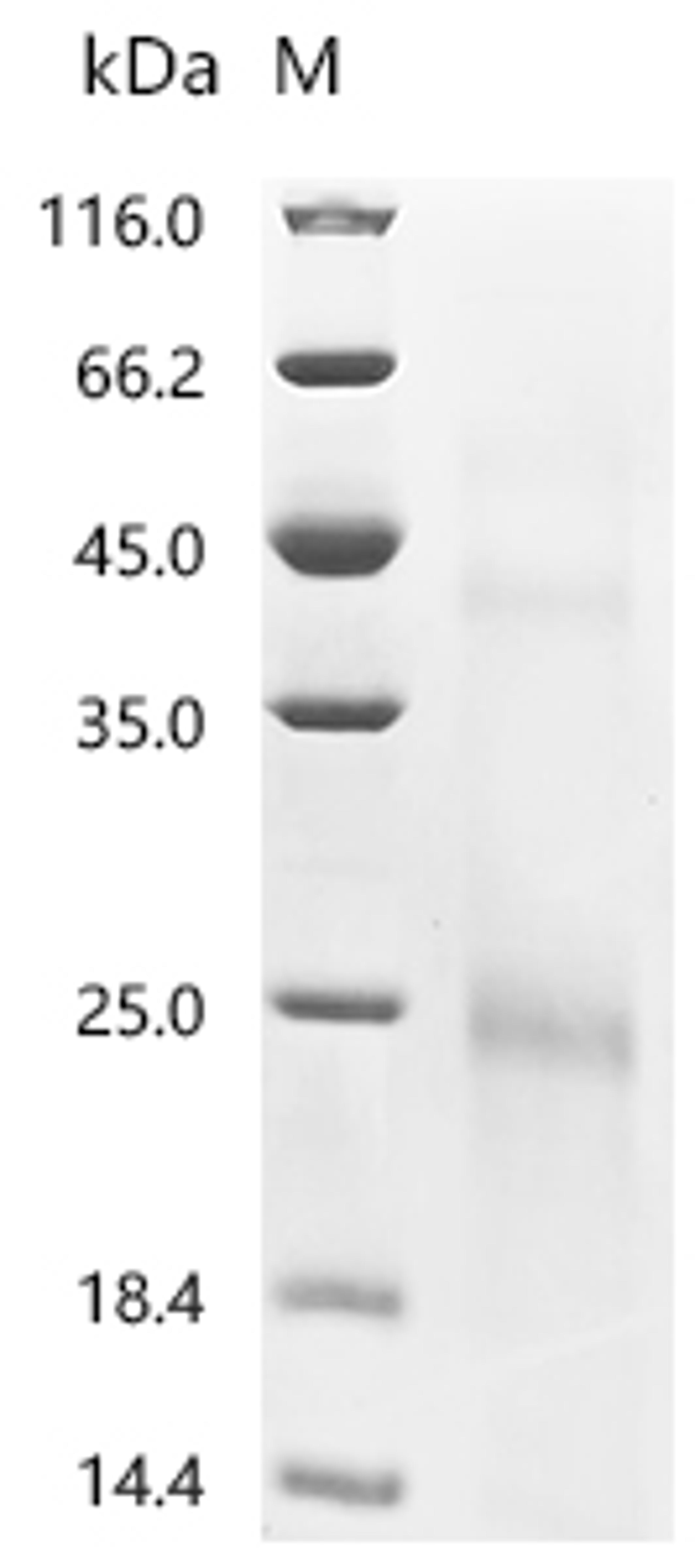 (Tris-Glycine gel) Discontinuous SDS-PAGE (reduced) with 5% enrichment gel and 15% separation gel.