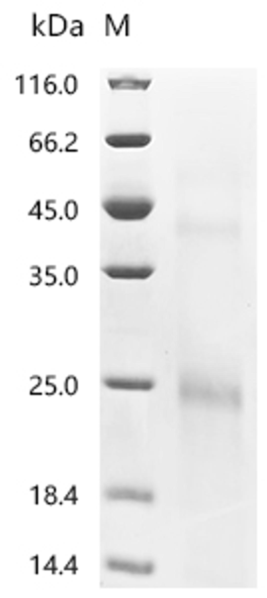 (Tris-Glycine gel) Discontinuous SDS-PAGE (reduced) with 5% enrichment gel and 15% separation gel.
