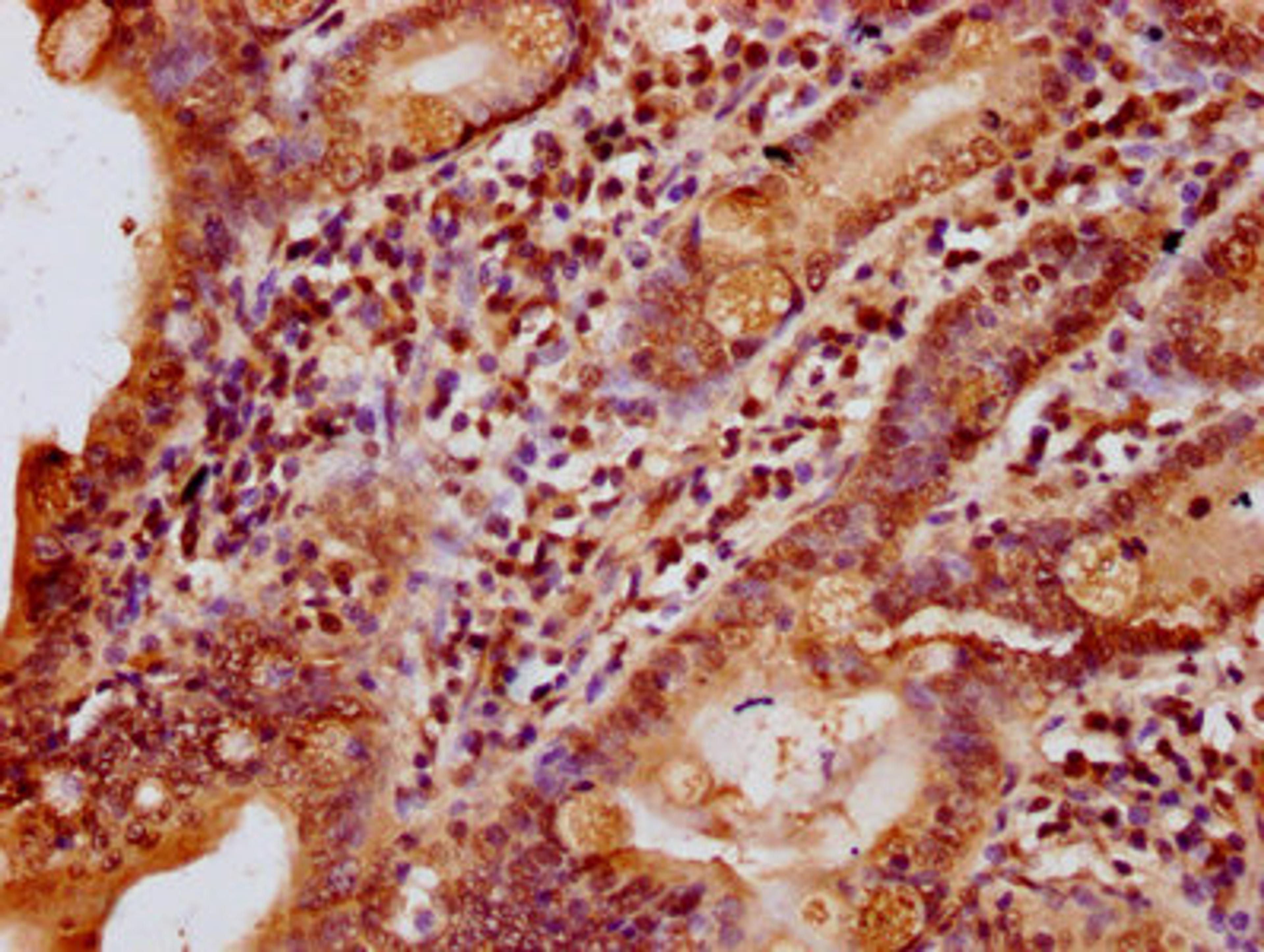 IHC image of CSB-PA010378OA25nhibHU diluted at 1:10 and staining in paraffin-embedded human small intestine tissue performed on a Leica BondTM system. After dewaxing and hydration, antigen retrieval was mediated by high pressure in a citrate buffer (pH 6.0). Section was blocked with 10% normal goat serum 30min at RT. Then primary antibody (1% BSA) was incubated at 4&deg;C overnight. The primary is detected by a biotinylated secondary antibody and visualized using an HRP conjugated SP system.