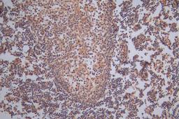 IHC image of CSB-RA008642MA1HU diluted at 1:50 and staining in paraffin-embedded human tonsil tissue performed on a Leica BondTM system. After dewaxing and hydration,  antigen retrieval was mediated by high pressure in a citrate buffer (pH 6.0). Section was blocked with 10% normal goat serum 30min at RT. Then primary antibody (1% BSA) was incubated at 4°C overnight. The primary is detected by a Goat anti-Rabbit IgG labeled by HRP and visualized using 0.05% DAB.