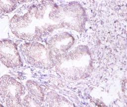 Immunohistochemistry of paraffin-embedded human prostate tissue using CSB-PA00575A0Rb at dilution of 1:100