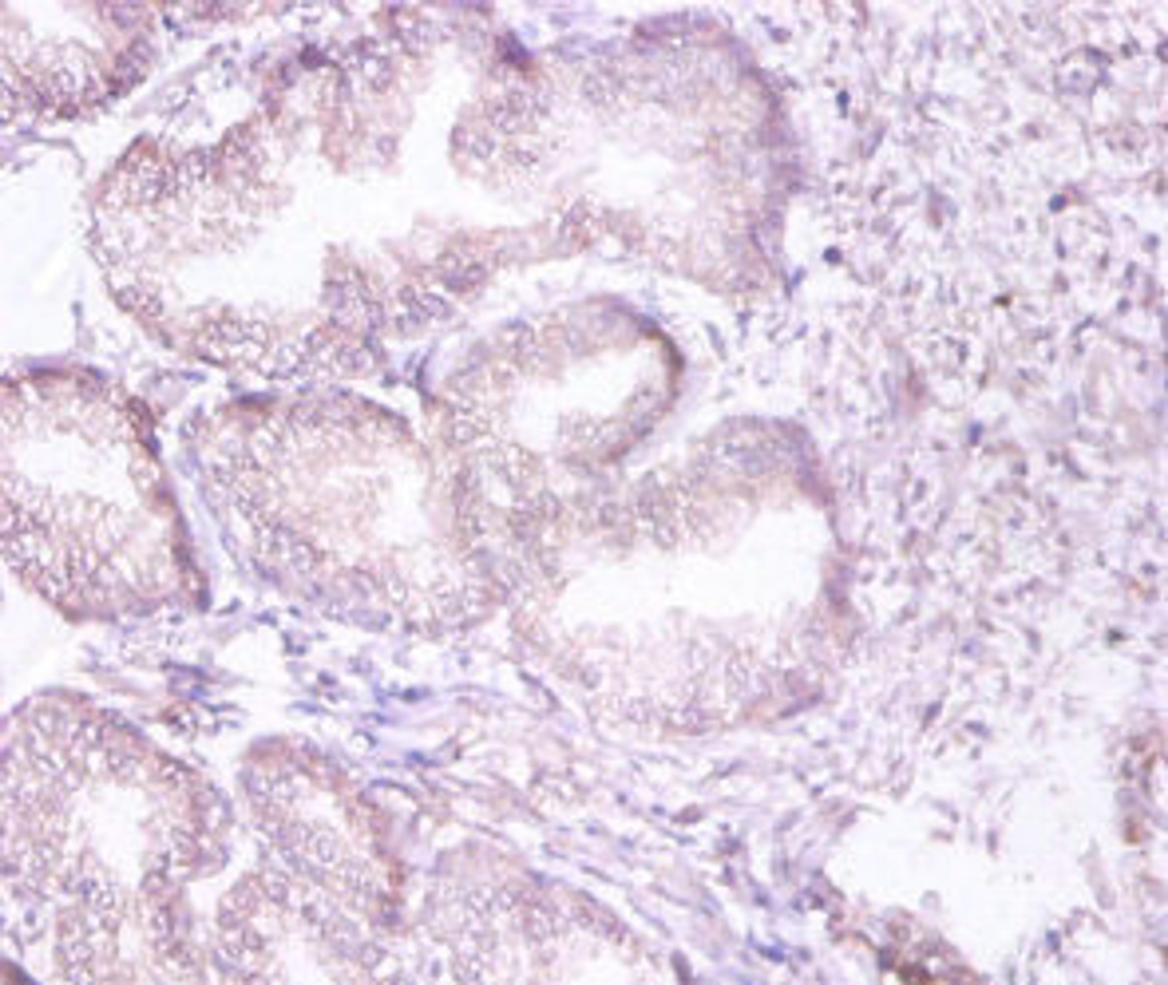 Immunohistochemistry of paraffin-embedded human prostate tissue using CSB-PA00575A0Rb at dilution of 1:100