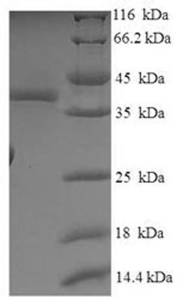 (Tris-Glycine gel) Discontinuous SDS-PAGE (reduced) with 5% enrichment gel and 15% separation gel.