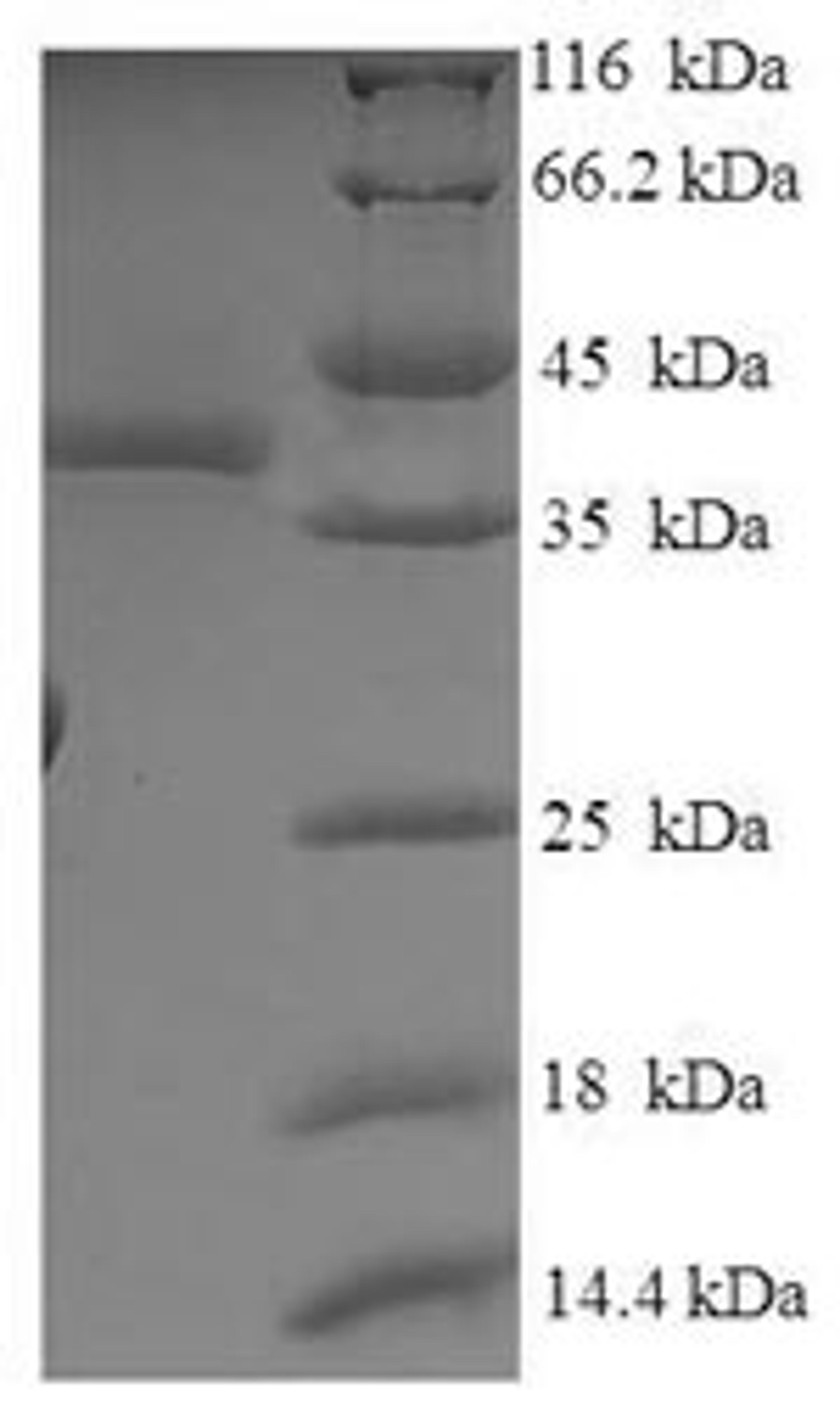 (Tris-Glycine gel) Discontinuous SDS-PAGE (reduced) with 5% enrichment gel and 15% separation gel.