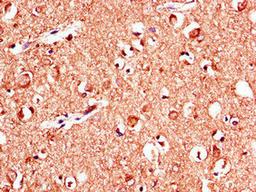 Immunohistochemistry of paraffin-embedded human brain tissue using CSB-PA12729A0Rb at dilution of 1:100