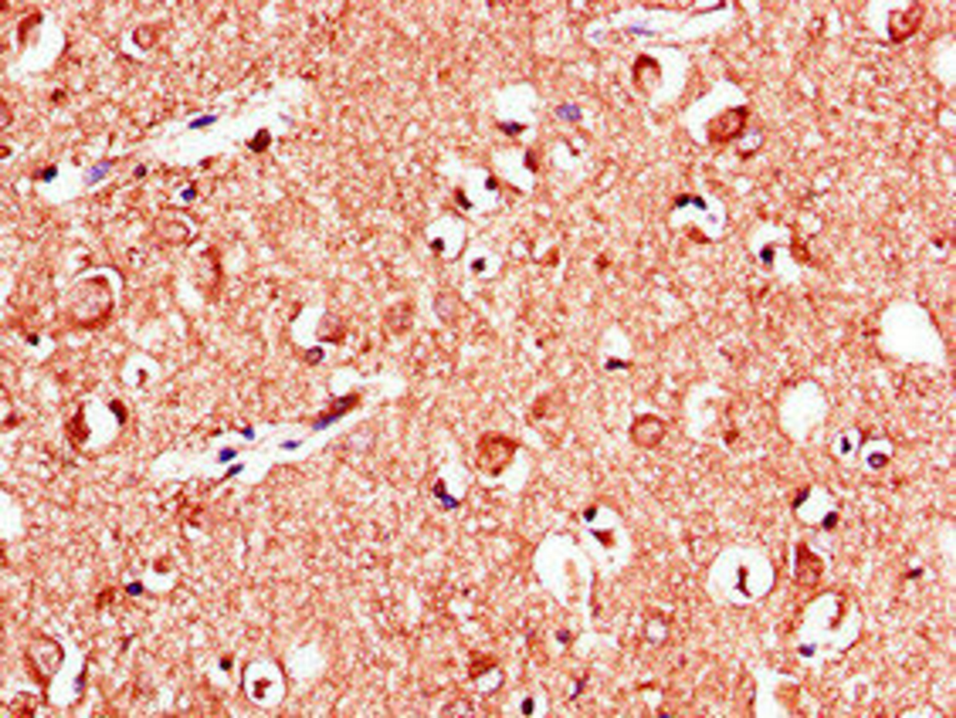 Immunohistochemistry of paraffin-embedded human brain tissue using CSB-PA12729A0Rb at dilution of 1:100