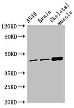 Western Blot. Positive WB detected in: A549 whole cell lysate, Mouse brain tissue, Mouse skeletal muscle tissue. All lanes: TMEM43 antibody at 4µg/ml. Secondary. Goat polyclonal to rabbit IgG at 1/50000 dilution. Predicted band size: 45 kDa. Observed band size: 45 kDa