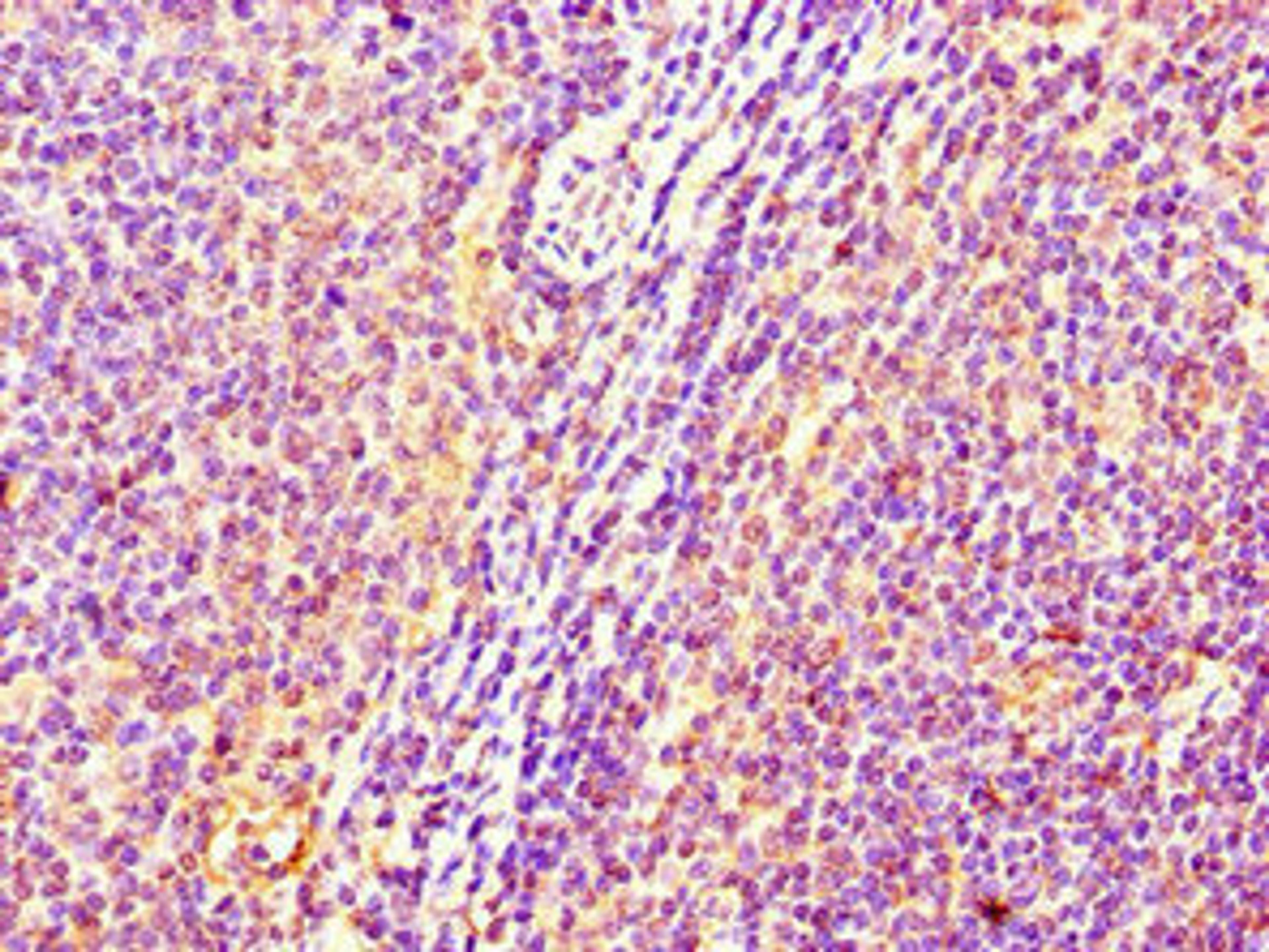 Immunohistochemistry of paraffin-embedded human lymph node tissue using CSB-PA643573LA01HU at dilution of 1:100