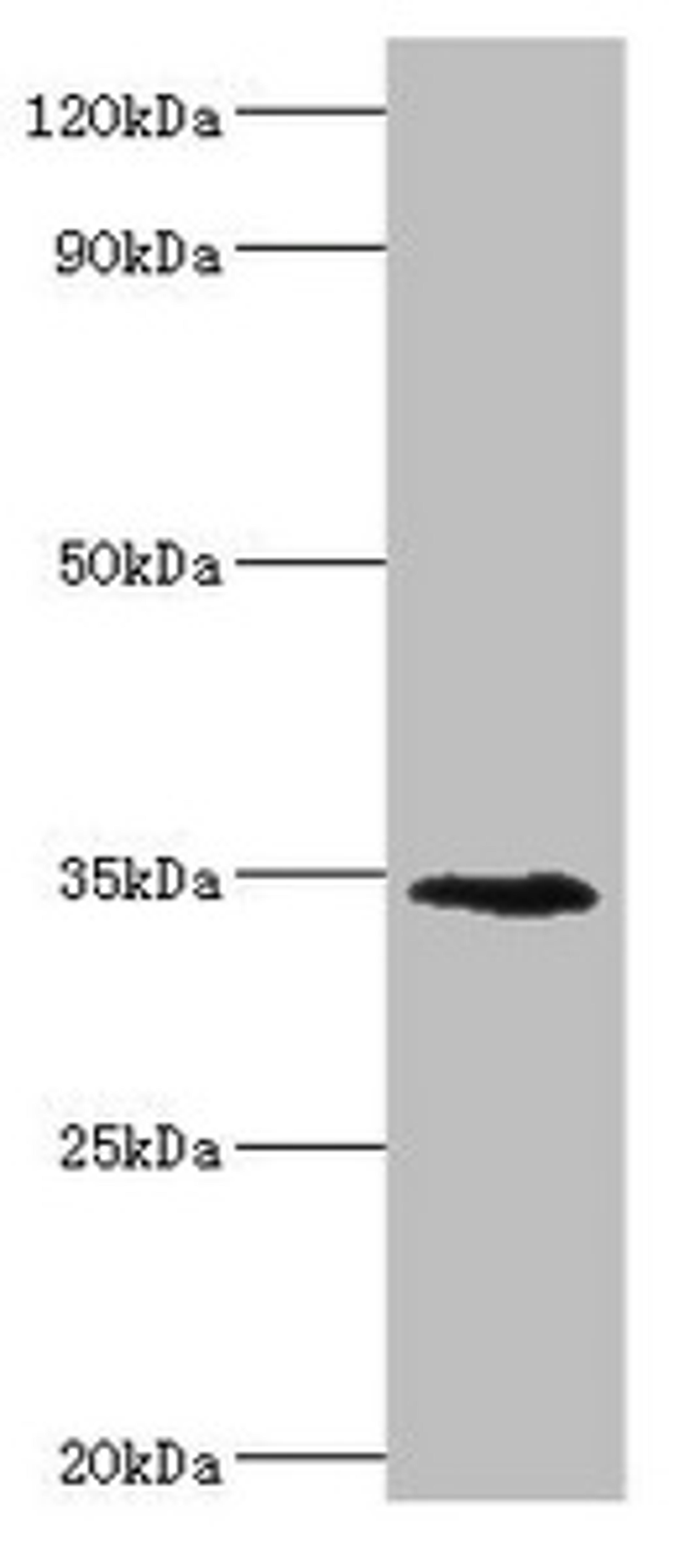 Western blot. All lanes: Lymphatic vessel endothelial hyaluronic acid receptor 1 antibody at 8ug/ml + Mouse liver tissue. Secondary. Goat polyclonal to rabbit IgG at 1/10000 dilution. Predicted band size: 35 kDa. Observed band size: 35 kDa. 