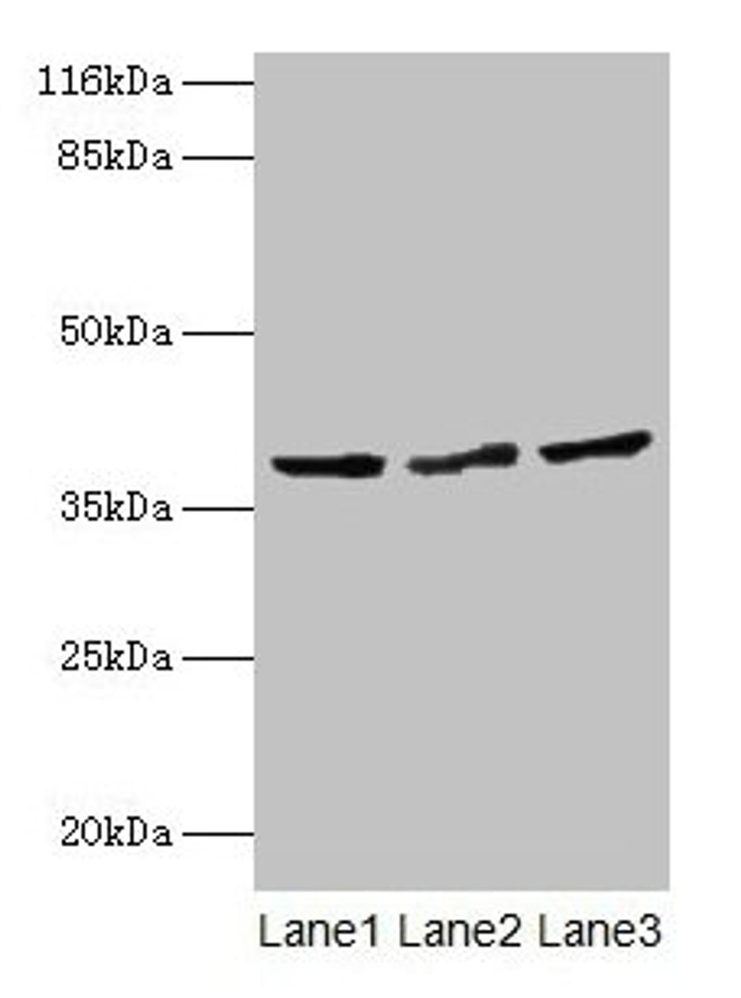 Western blot. All lanes: CRYZL1 antibody at 12µg/ml. Lane 1: Hela whole cell lysate. Lane 2: HepG2 whole cell lysate. Lane 3: Jurkat whole cell lysate. Secondary. Goat polyclonal to rabbit IgG at 1/10000 dilution. Predicted band size: 39, 22 kDa. Observed band size: 39 kDa