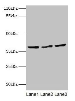 Western blot. All lanes: CRYZL1 antibody at 12µg/ml. Lane 1: Hela whole cell lysate. Lane 2: HepG2 whole cell lysate. Lane 3: Jurkat whole cell lysate. Secondary. Goat polyclonal to rabbit IgG at 1/10000 dilution. Predicted band size: 39, 22 kDa. Observed band size: 39 kDa