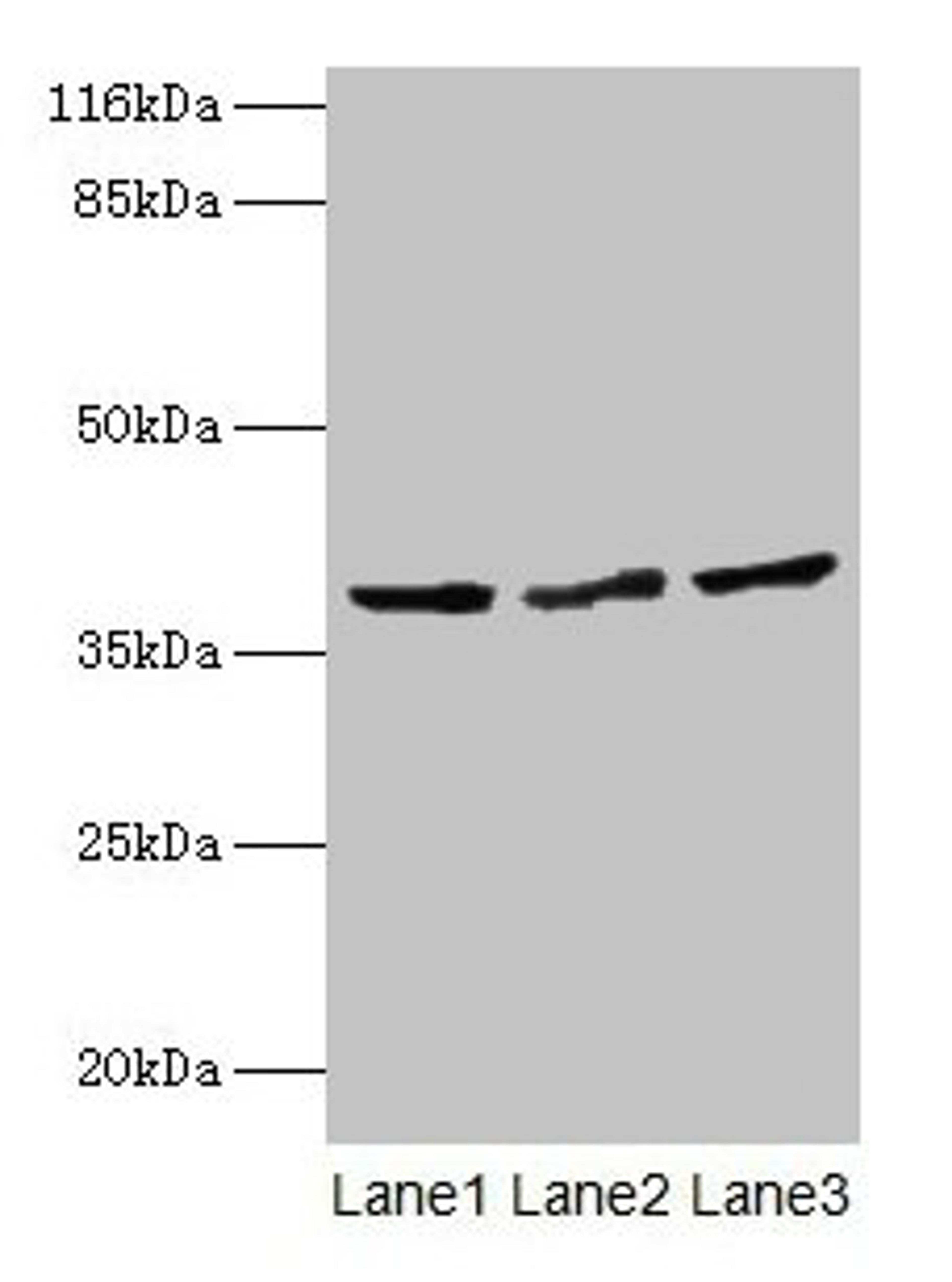 Western blot. All lanes: CRYZL1 antibody at 12µg/ml. Lane 1: Hela whole cell lysate. Lane 2: HepG2 whole cell lysate. Lane 3: Jurkat whole cell lysate. Secondary. Goat polyclonal to rabbit IgG at 1/10000 dilution. Predicted band size: 39, 22 kDa. Observed band size: 39 kDa