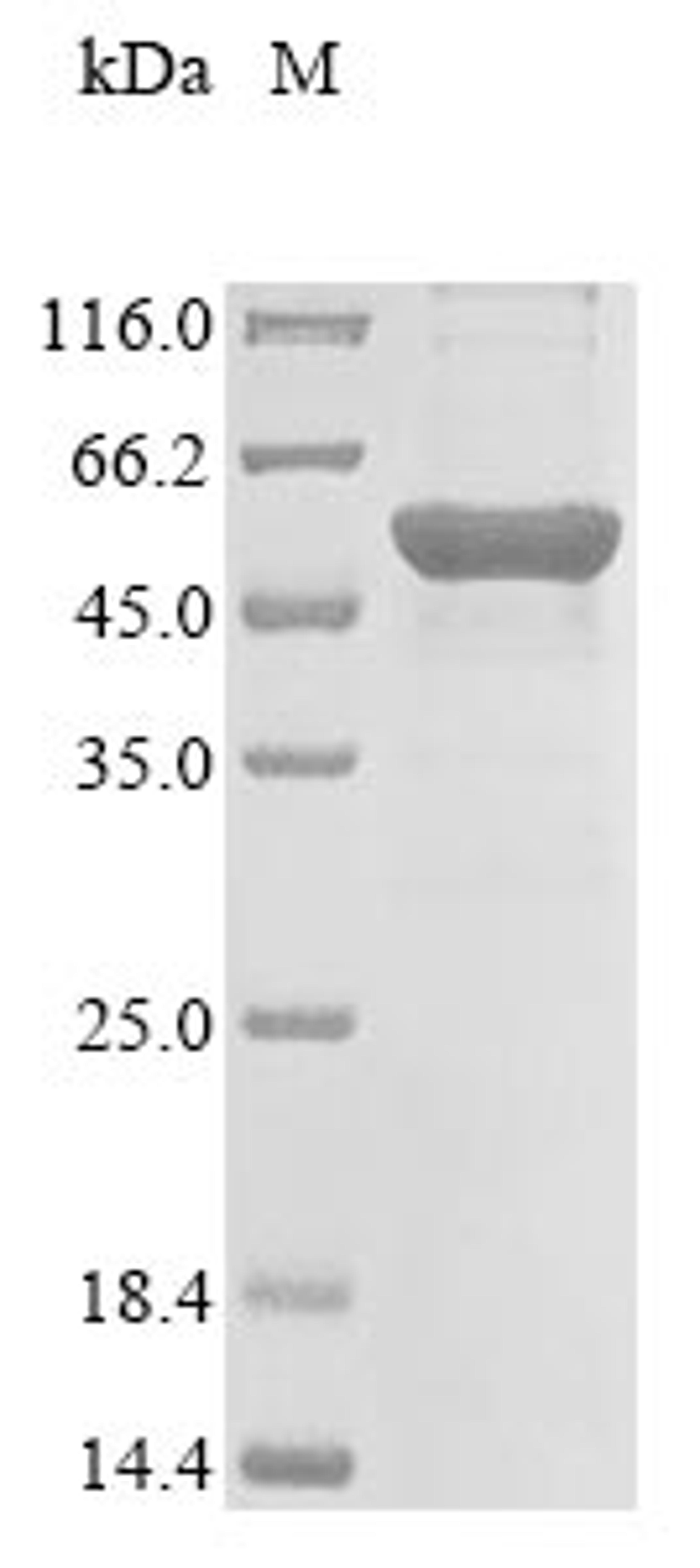 (Tris-Glycine gel) Discontinuous SDS-PAGE (reduced) with 5% enrichment gel and 15% separation gel.