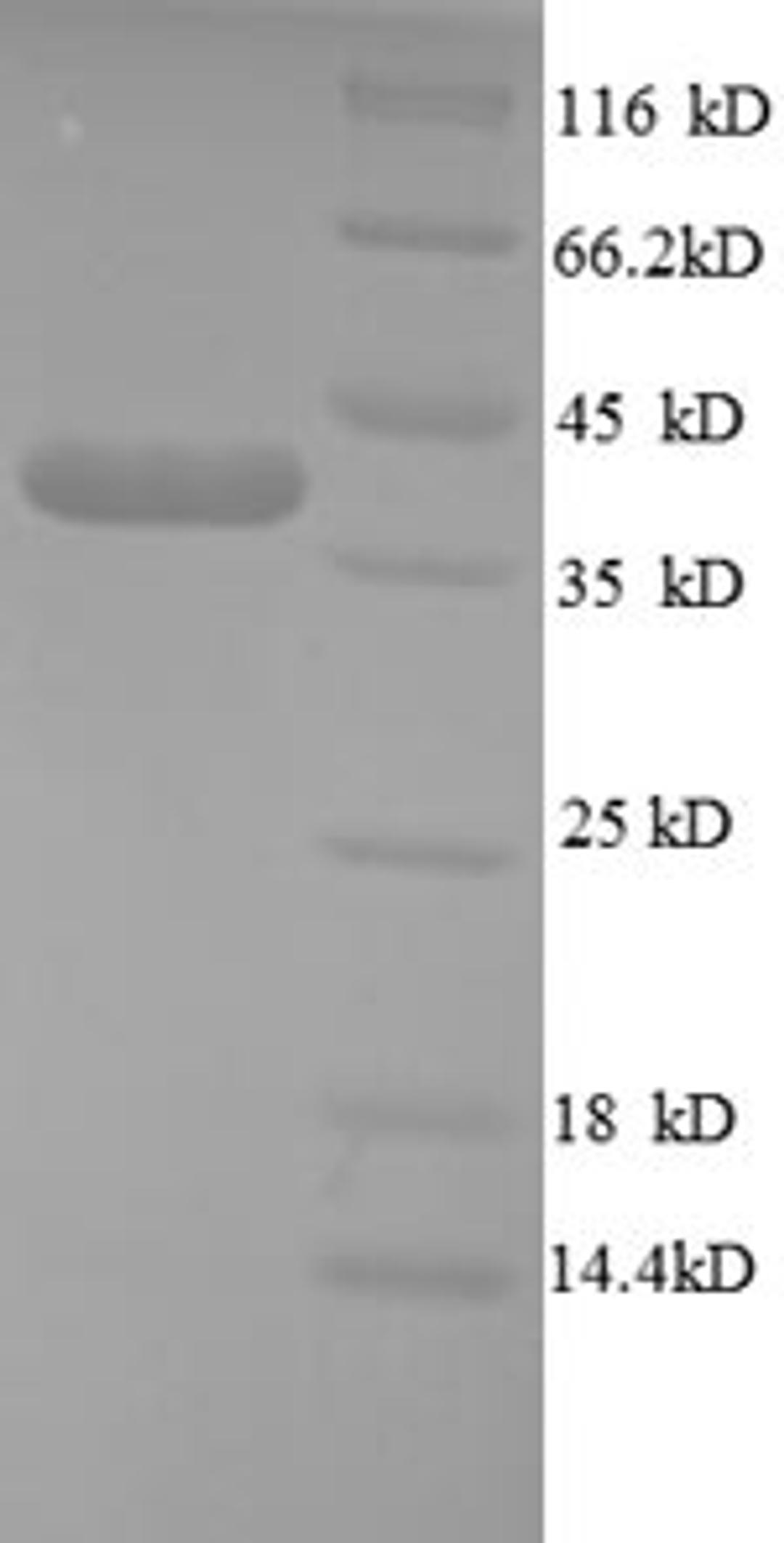 (Tris-Glycine gel) Discontinuous SDS-PAGE (reduced) with 5% enrichment gel and 15% separation gel.