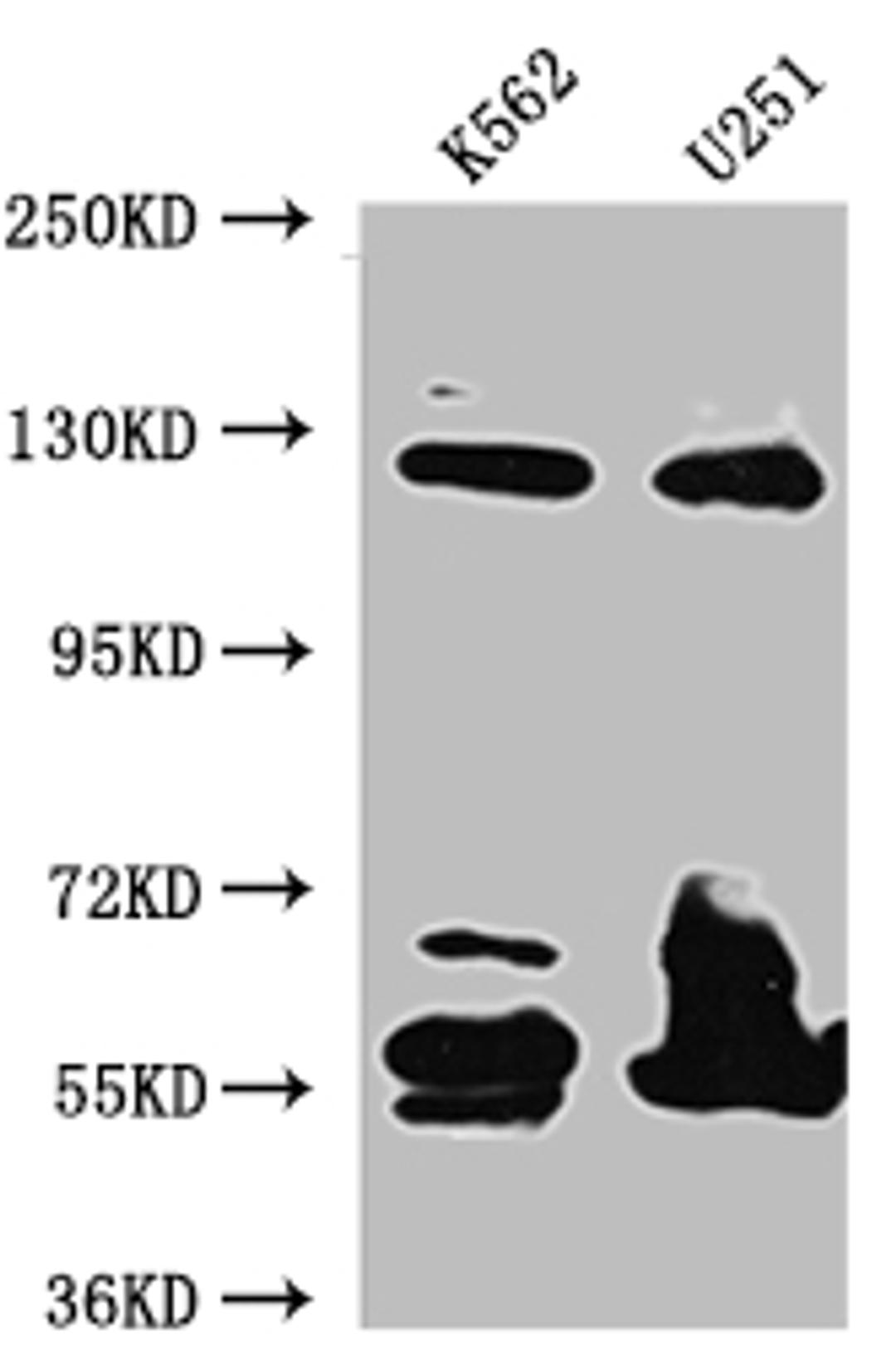 Western Blot. Positive WB detected in: K562 whole cell lysate, U-251 whole cell lysate. All lanes: BubR1 antibody at 1:1000. Secondary. Goat polyclonal to rabbit IgG at 1/50000 dilution. Predicted band size: 120, 106, 122 kDa. Observed band size: 125 kDa. 