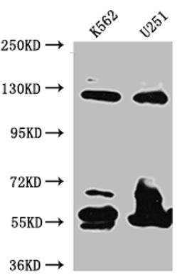 Western Blot. Positive WB detected in: K562 whole cell lysate, U-251 whole cell lysate. All lanes: BubR1 antibody at 1:1000. Secondary. Goat polyclonal to rabbit IgG at 1/50000 dilution. Predicted band size: 120, 106, 122 kDa. Observed band size: 125 kDa. 