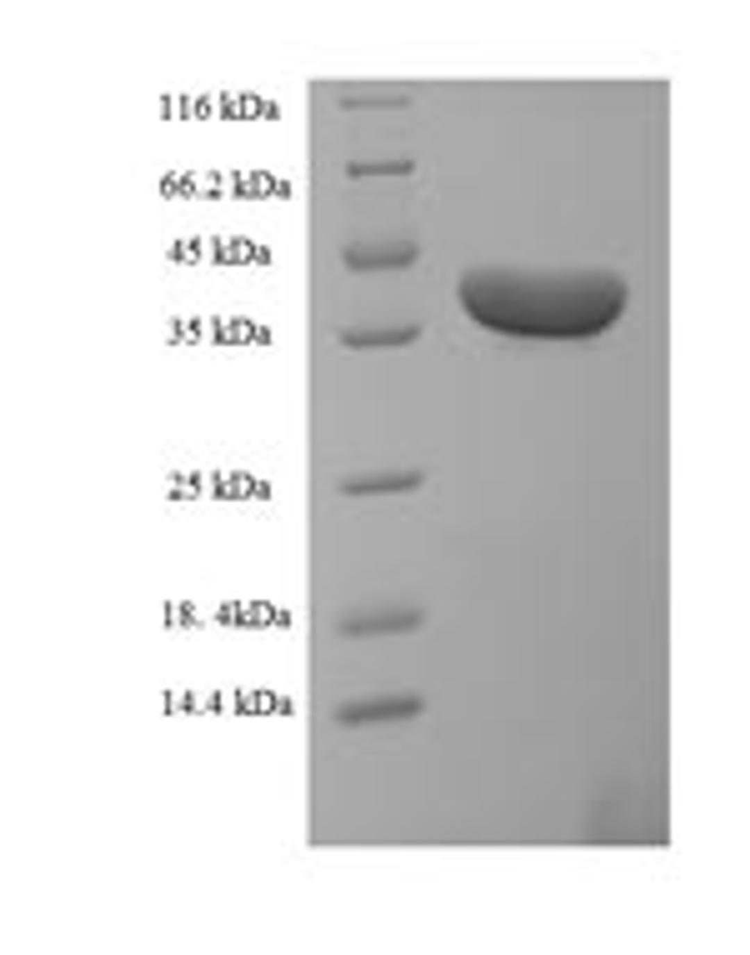 (Tris-Glycine gel) Discontinuous SDS-PAGE (reduced) with 5% enrichment gel and 15% separation gel.