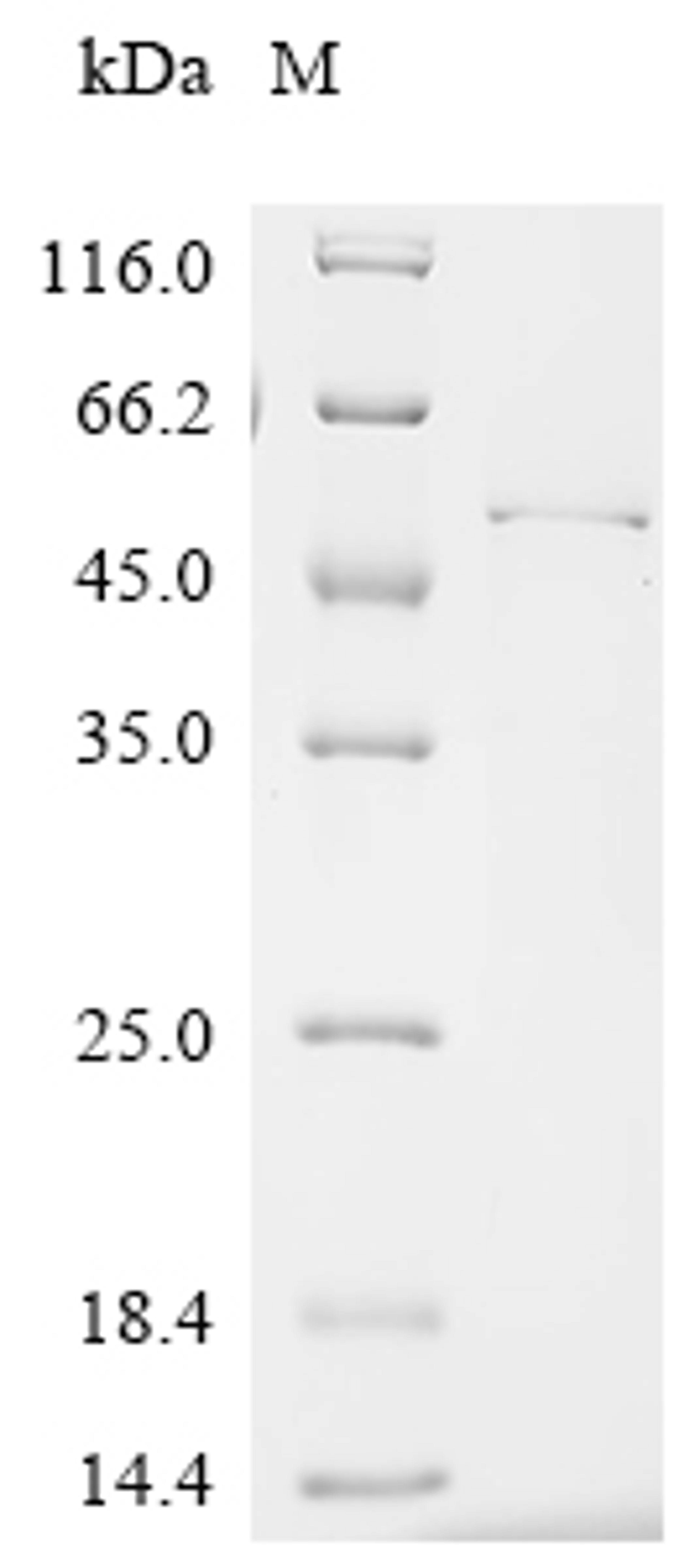 (Tris-Glycine gel) Discontinuous SDS-PAGE (reduced) with 5% enrichment gel and 15% separation gel.