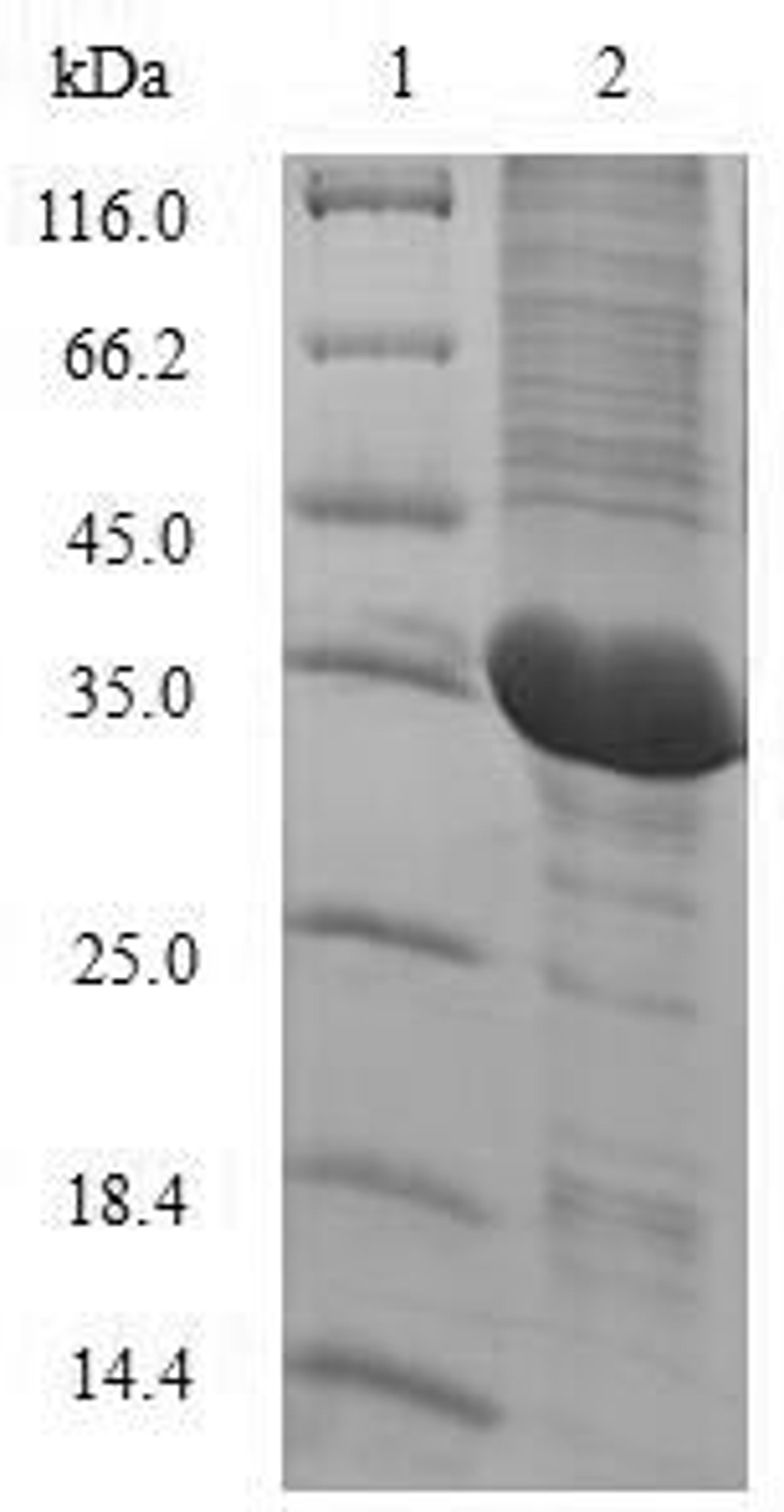 (Tris-Glycine gel) Discontinuous SDS-PAGE (reduced) with 5% enrichment gel and 15% separation gel.