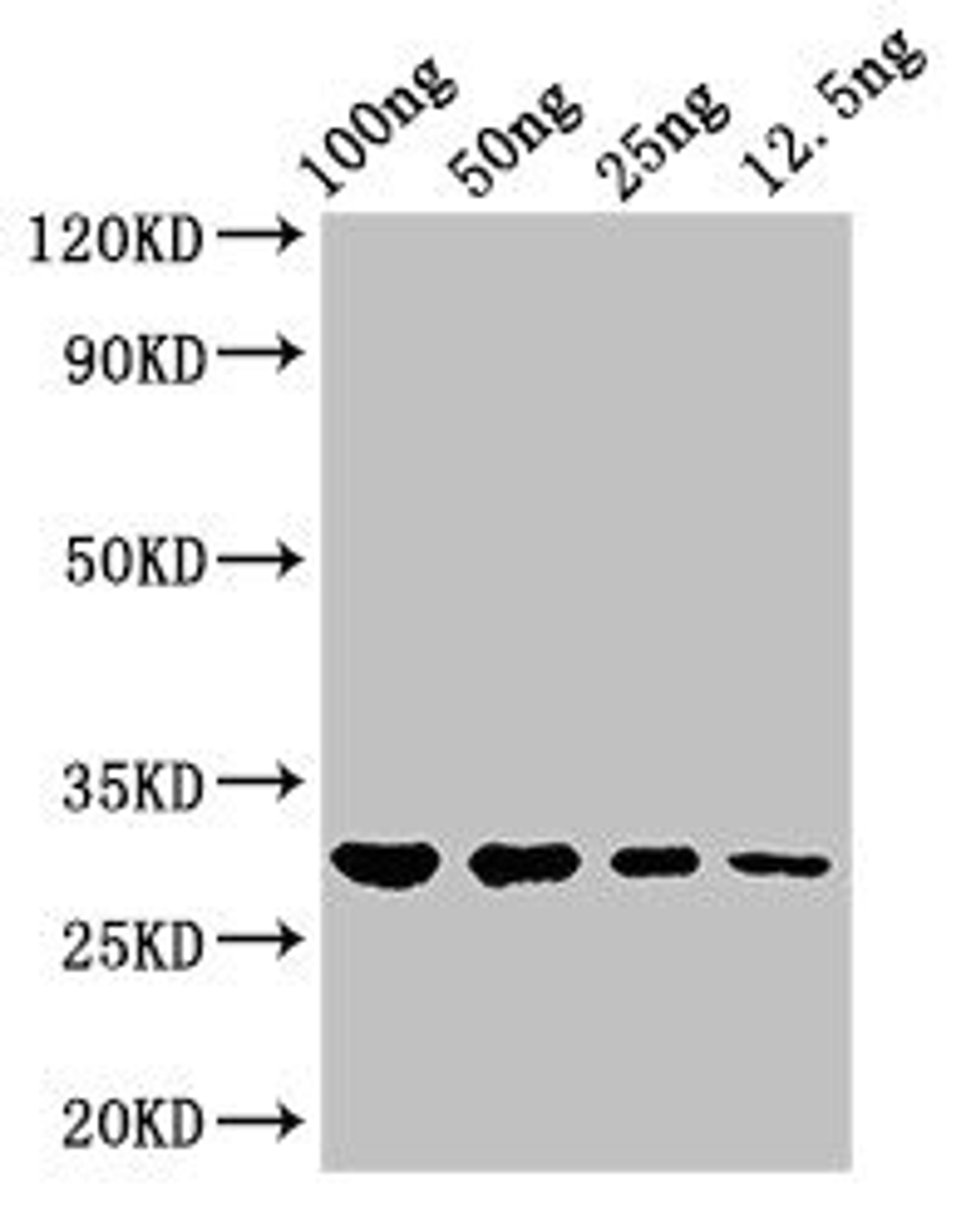 Western Blot. Positive WB detected in Recombinant protein. All lanes: hupB antibody at 3µg/ml. Secondary. Goat polyclonal to rabbit IgG at 1/50000 dilution. Predicted band size: 30 kDa. Observed band size: 30 kDa