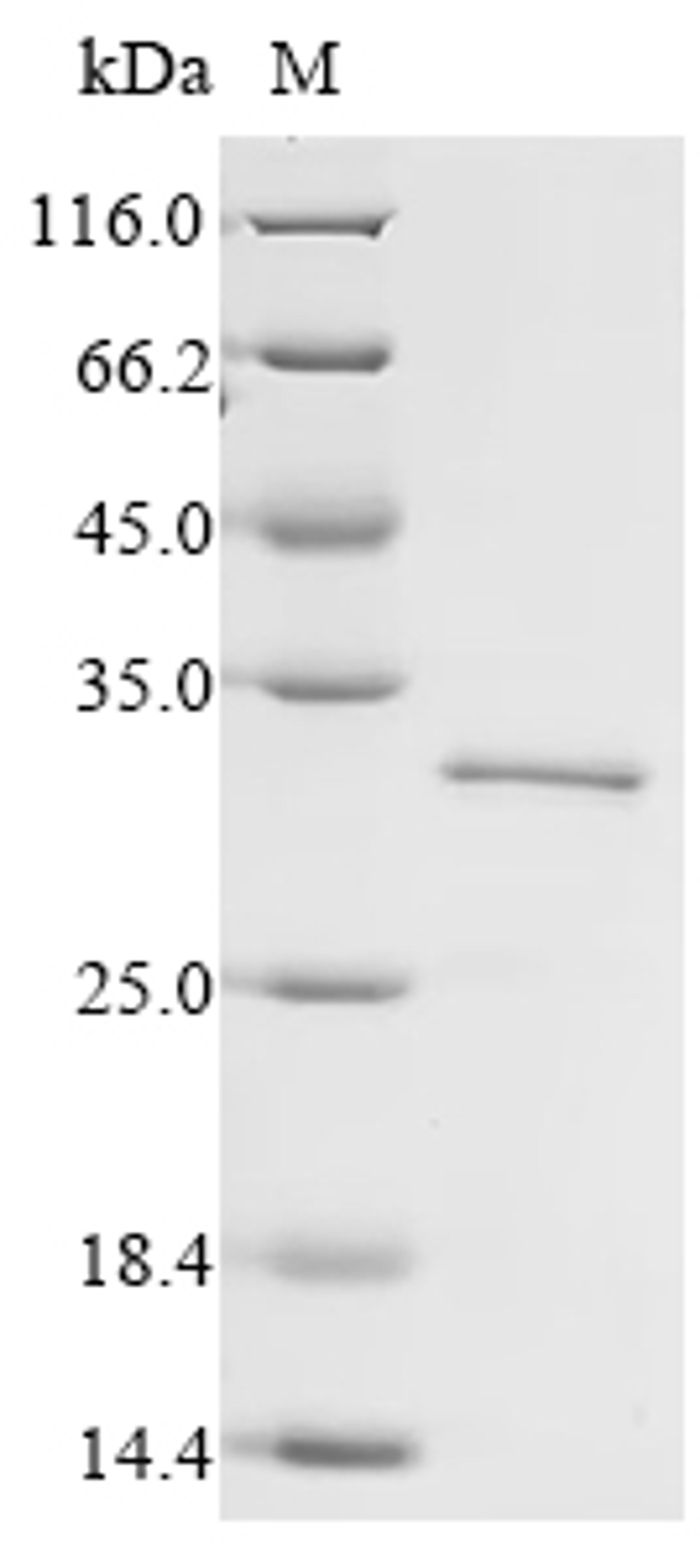 (Tris-Glycine gel) Discontinuous SDS-PAGE (reduced) with 5% enrichment gel and 15% separation gel.