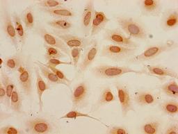 Immunocytochemistry analysis of Hela cells using CSB-PA010418PA04me2HU at dilution of 1:100