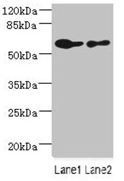 Western blot. All lanes: CHRNA6 antibody at 2.29µg/ml. Lane 1: A431 whole cell lysate. Lane 2: THP-1 whole cell lysate. Secondary. Goat polyclonal to rabbit IgG at 1/10000 dilution. Predicted band size: 57, 56 kDa. Observed band size: 57 kDa