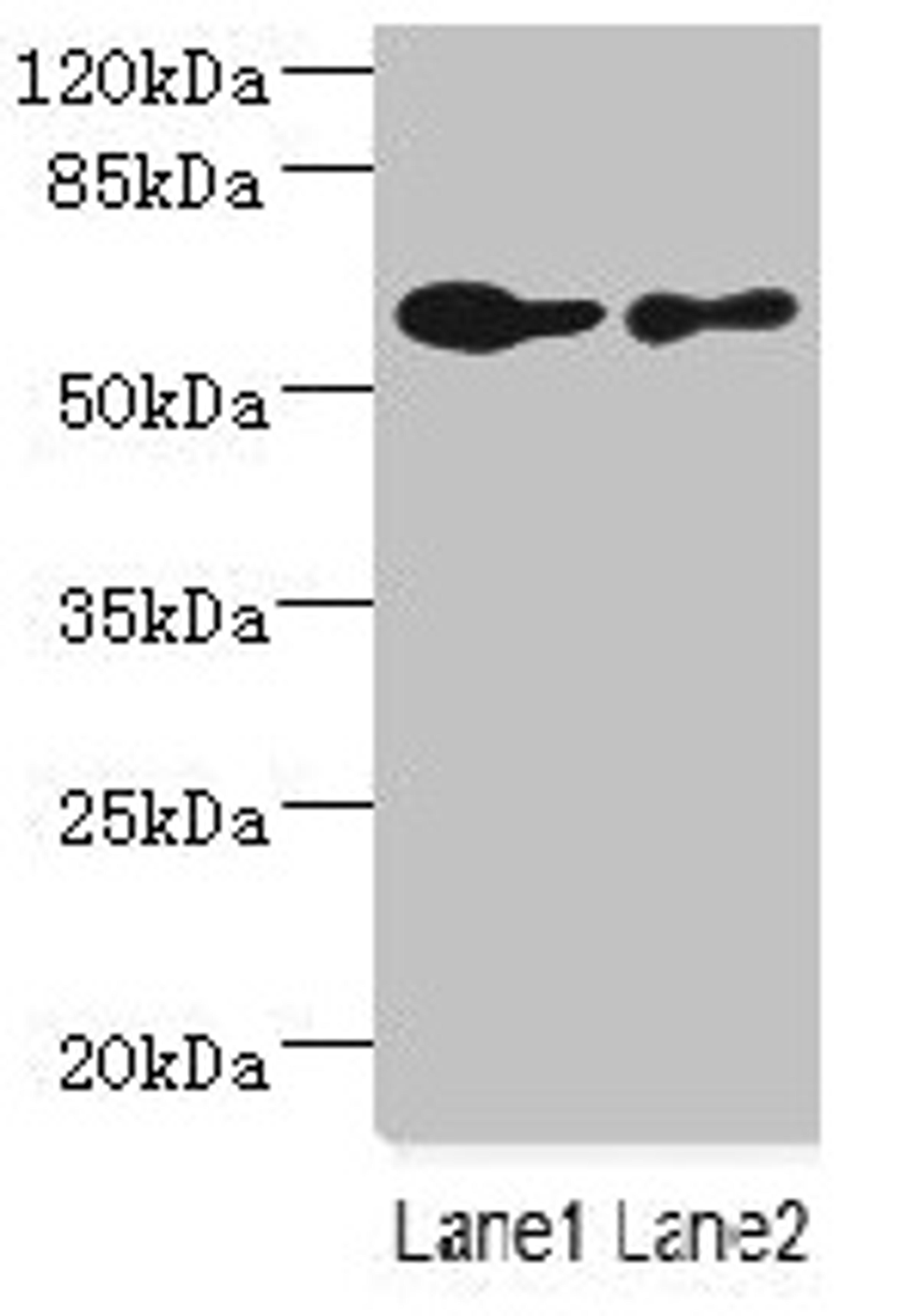 Western blot. All lanes: CHRNA6 antibody at 2.29µg/ml. Lane 1: A431 whole cell lysate. Lane 2: THP-1 whole cell lysate. Secondary. Goat polyclonal to rabbit IgG at 1/10000 dilution. Predicted band size: 57, 56 kDa. Observed band size: 57 kDa