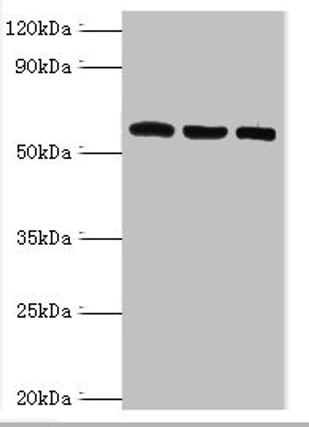 Western blot. All lanes: Thioredoxin reductase 2, mitochondrial antibody at 6ug/ml. Lane 1: Mouse liver tissue. Lane 2: Mouse gonad tissue. Lane 3: Hela whole cell lysate. Secondary. Goat polyclonal to rabbit IgG at 1/10000 dilution. Predicted band size: 57, 54, 47, 31 kDa. Observed band size: 57 kDa. 