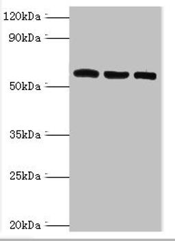 Western blot. All lanes: Thioredoxin reductase 2, mitochondrial antibody at 6ug/ml. Lane 1: Mouse liver tissue. Lane 2: Mouse gonad tissue. Lane 3: Hela whole cell lysate. Secondary. Goat polyclonal to rabbit IgG at 1/10000 dilution. Predicted band size: 57, 54, 47, 31 kDa. Observed band size: 57 kDa. 