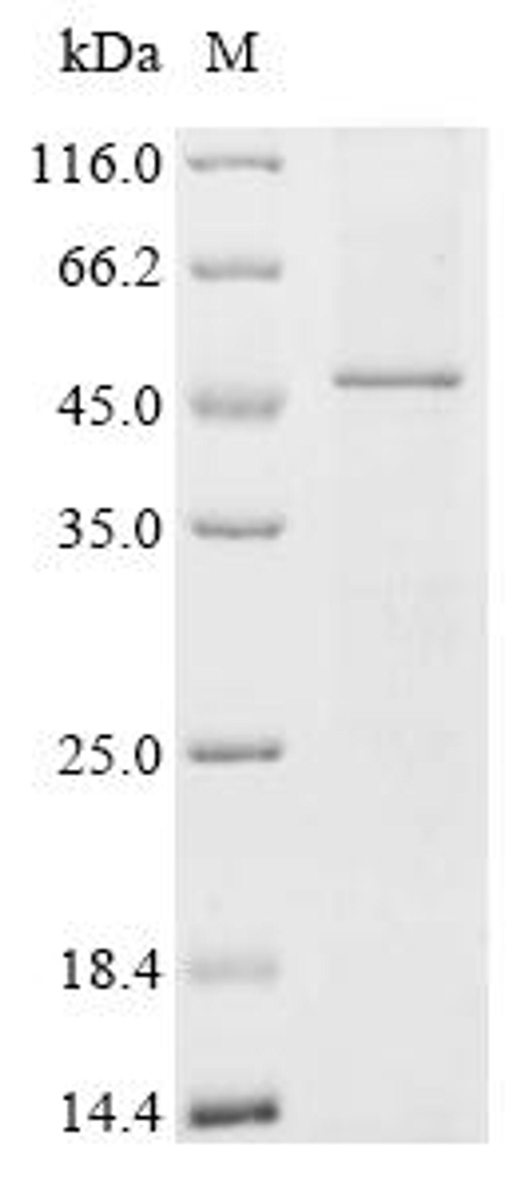 (Tris-Glycine gel) Discontinuous SDS-PAGE (reduced) with 5% enrichment gel and 15% separation gel.