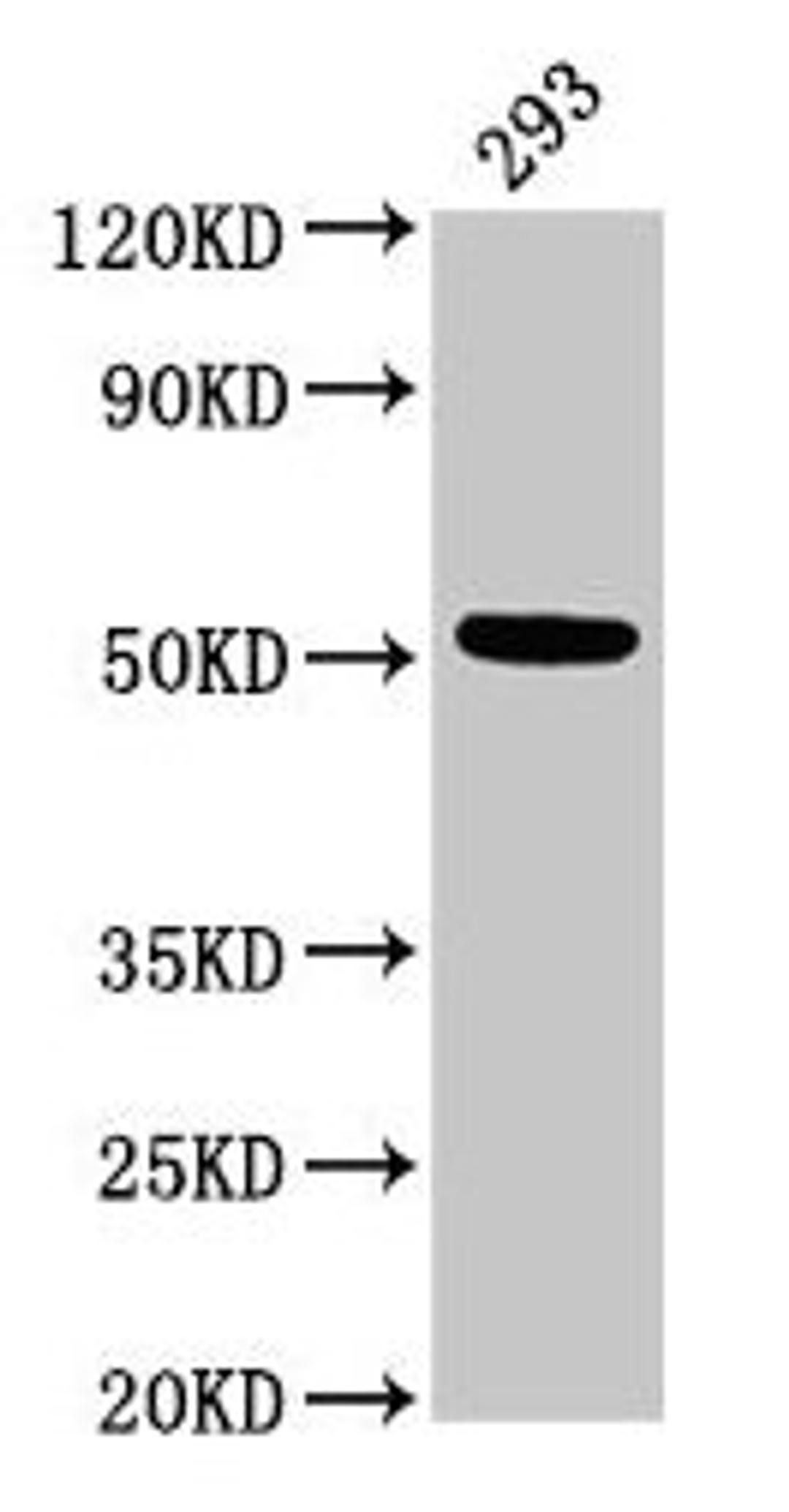 Western Blot. Positive WB detected in: 293 whole cell lysate. All lanes: TUBB3 antibody at 3µg/ml. Secondary. Goat polyclonal to rabbit IgG at 1/50000 dilution. Predicted band size: 51, 43 kDa. Observed band size: 51 kDa