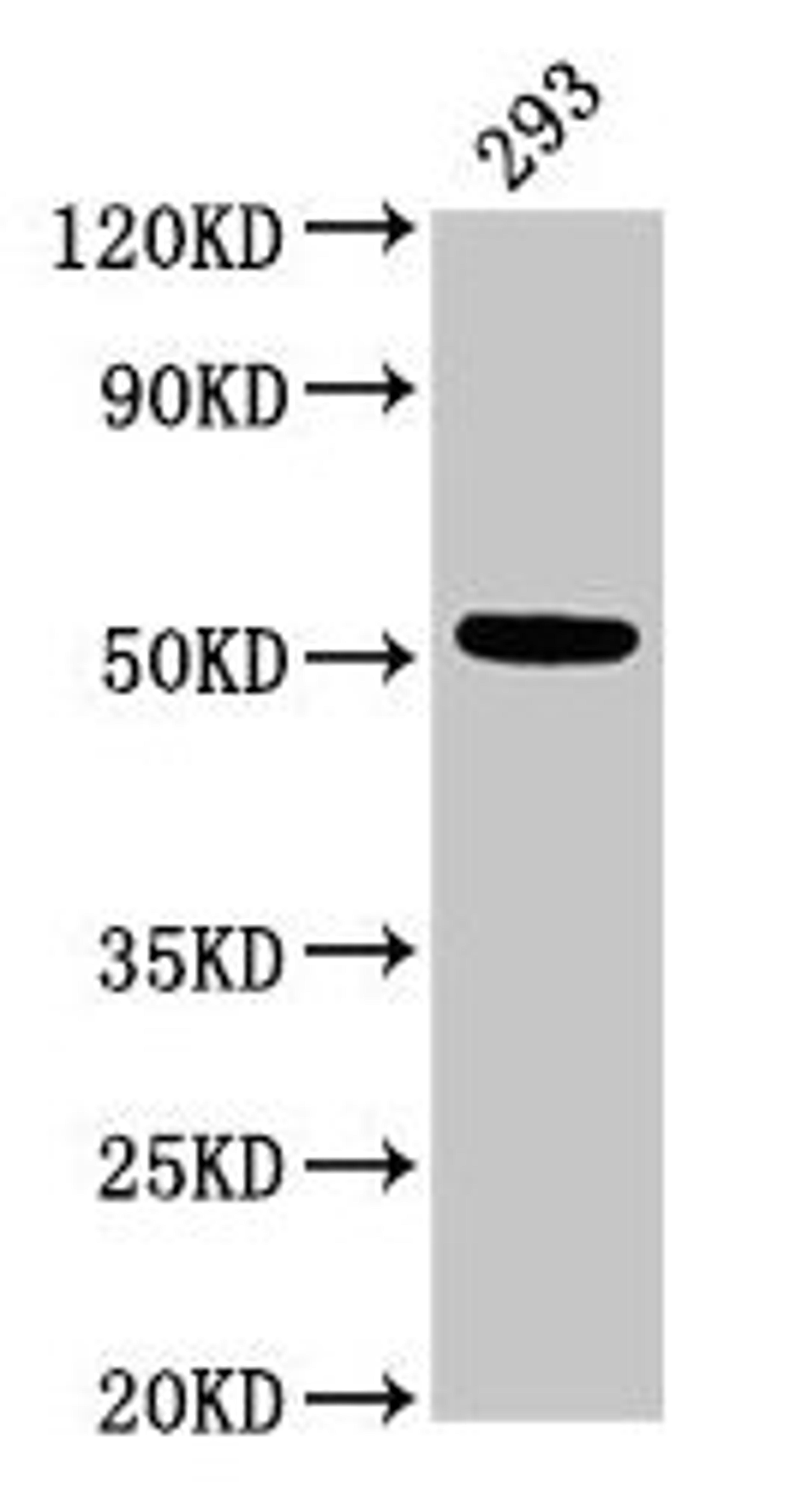 Western Blot. Positive WB detected in: 293 whole cell lysate. All lanes: TUBB3 antibody at 3µg/ml. Secondary. Goat polyclonal to rabbit IgG at 1/50000 dilution. Predicted band size: 51, 43 kDa. Observed band size: 51 kDa