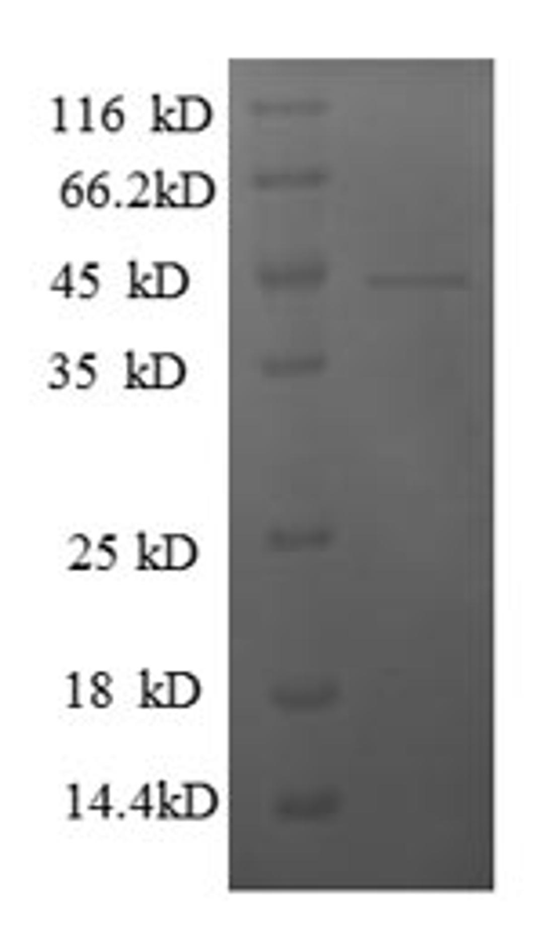 (Tris-Glycine gel) Discontinuous SDS-PAGE (reduced) with 5% enrichment gel and 15% separation gel.