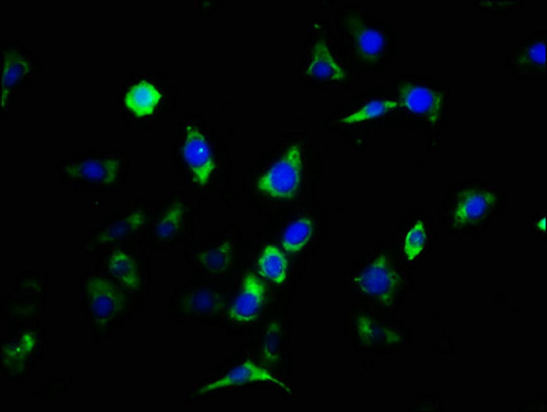Immunofluorescence staining of SH-SY5Y cells with CSB-PA005684EA01HU at 1:133, counter-stained with DAPI. The cells were fixed in 4% formaldehyde, permeabilized using 0.2% Triton X-100 and blocked in 10% normal Goat Serum. The cells were then incubated with the antibody overnight at 4&deg;C. The secondary antibody was Alexa Fluor 488-congugated AffiniPure Goat Anti-Rabbit IgG(H+L).