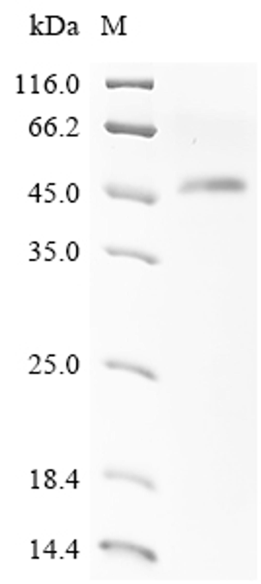 (Tris-Glycine gel) Discontinuous SDS-PAGE (reduced) with 5% enrichment gel and 15% separation gel.